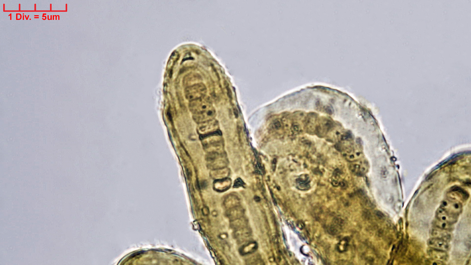 Cyanobacteria/Nostocales/Scytonemataceae/Petalonema/incrustans/petalonema-incrustans-419.jpg