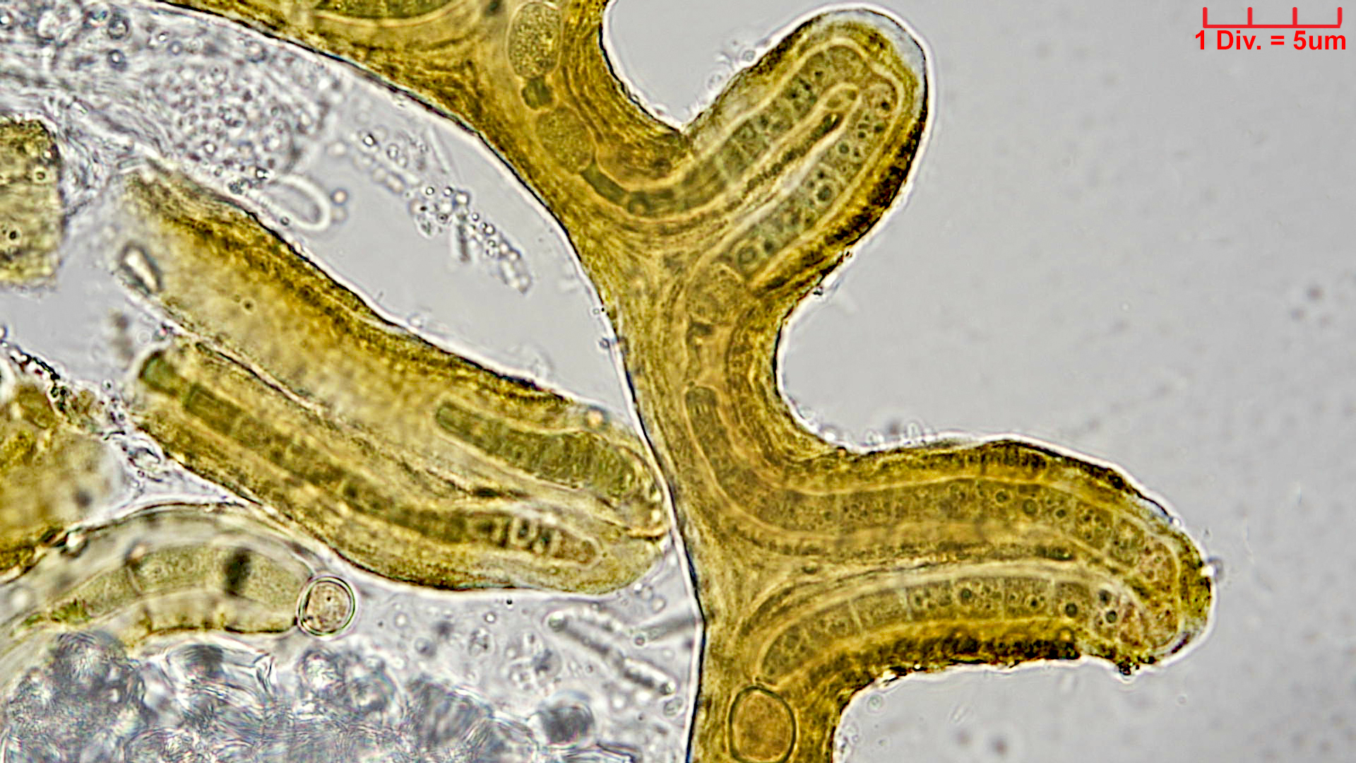 Cyanobacteria/Nostocales/Scytonemataceae/Petalonema/incrustans/petalonema-incrustans-420.jpg