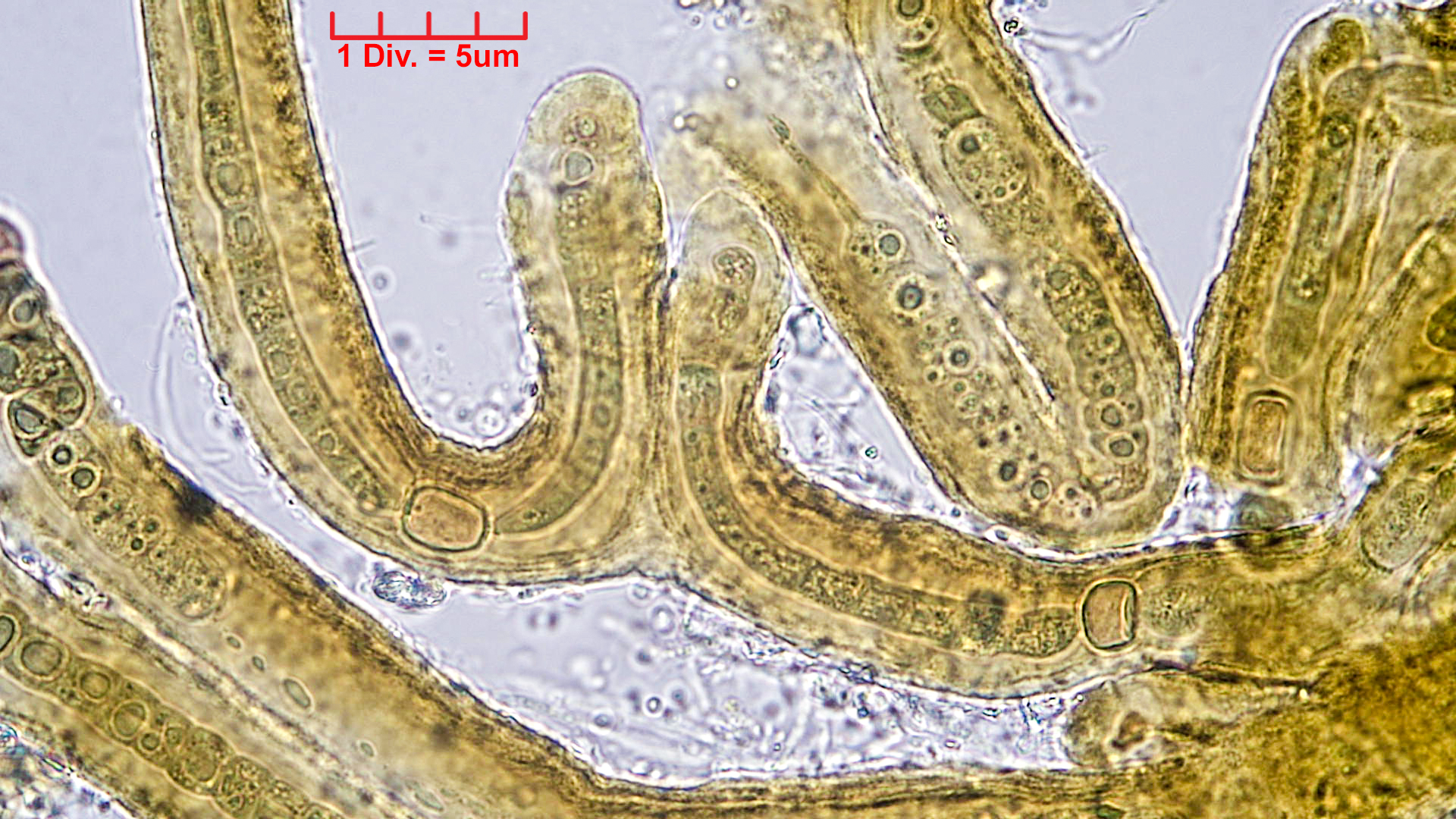 ./Cyanobacteria/Nostocales/Scytonemataceae/Petalonema/incrustans/petalonema-incrustans-421.jpg