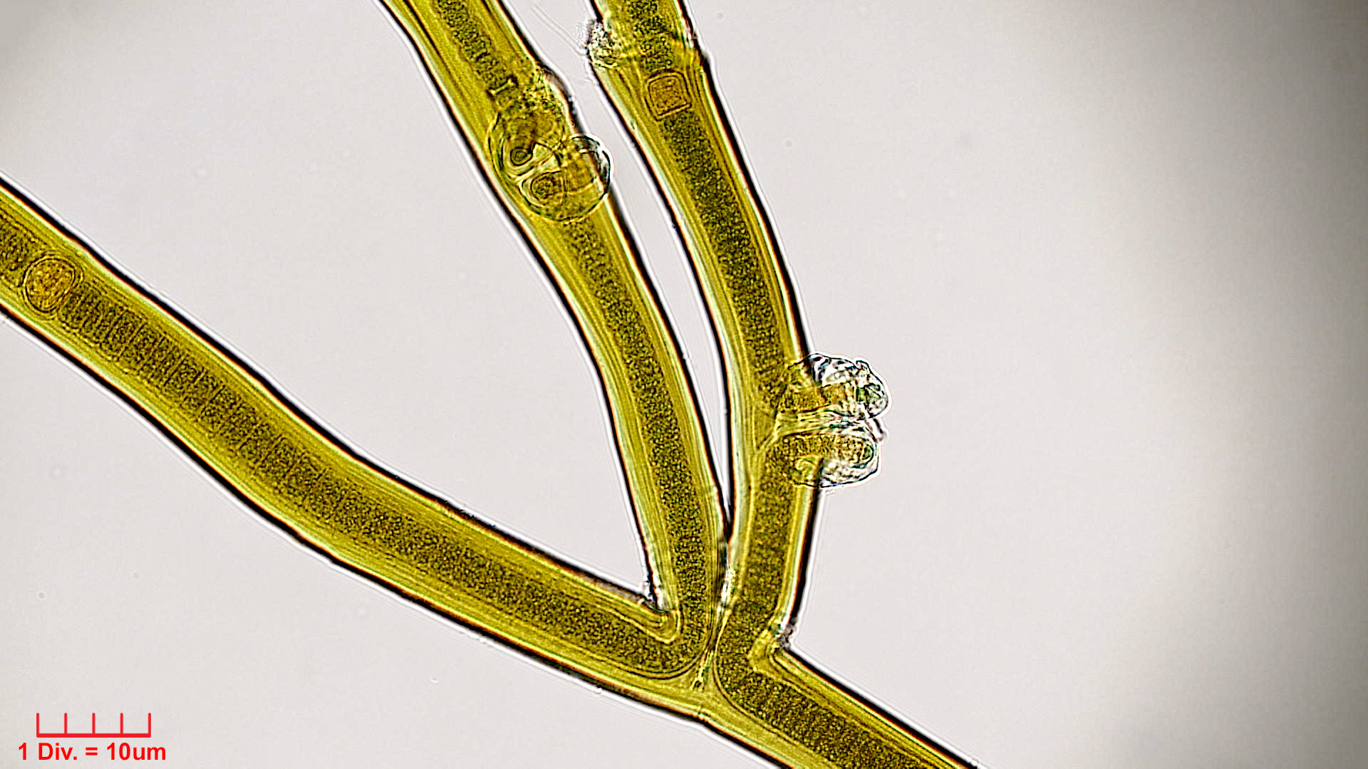 Cyanobacteria/Nostocales/Scytonemataceae/Scytonema/crispum/scytonema-crispum-353.jpg
