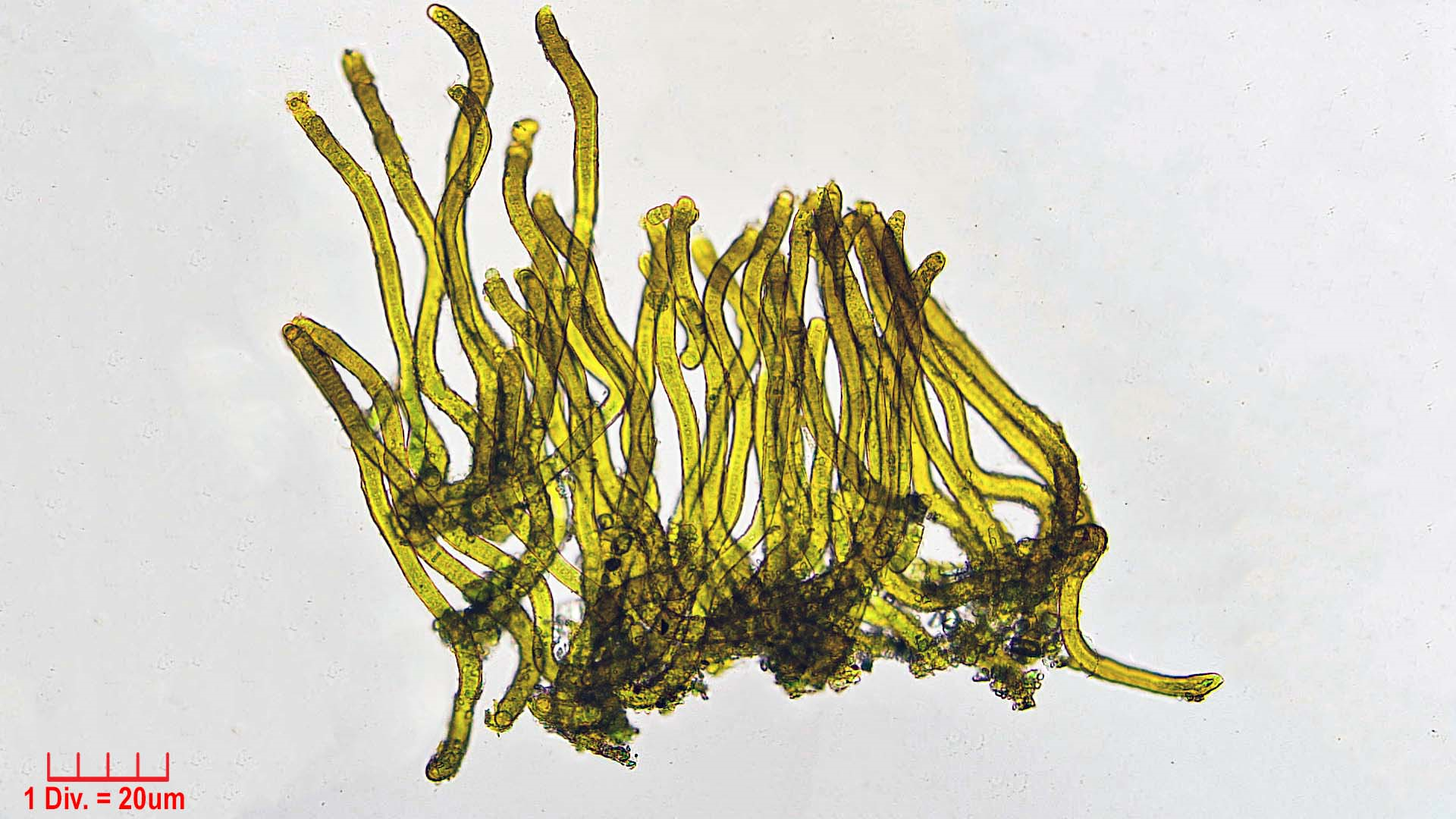 Cyanobacteria/Nostocales/Scytonemataceae/Scytonema/hofmannii/scytonema-hofmannii-390.png