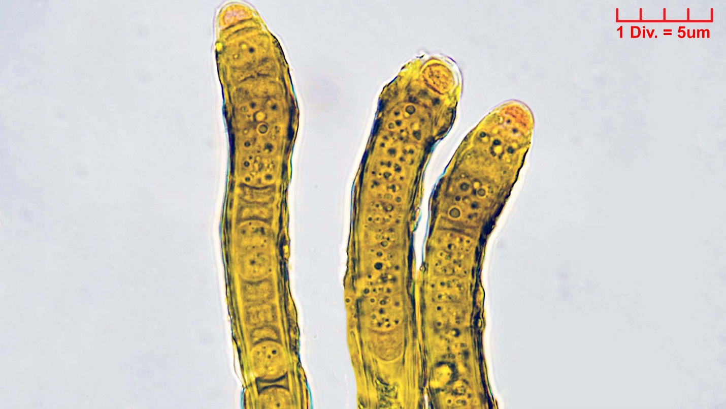 ././Cyanobacteria/Nostocales/Scytonemataceae/Scytonema/hofmannii/scytonema-hofmannii-391.png