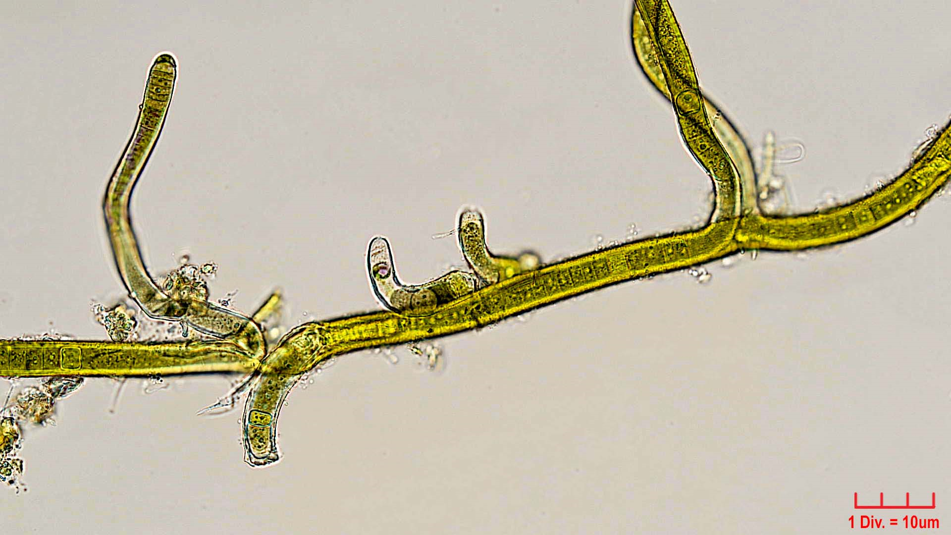 Cyanobacteria/Nostocales/Scytonemataceae/Scytonema/ocellatum/scytonema-ocellatum-384.png