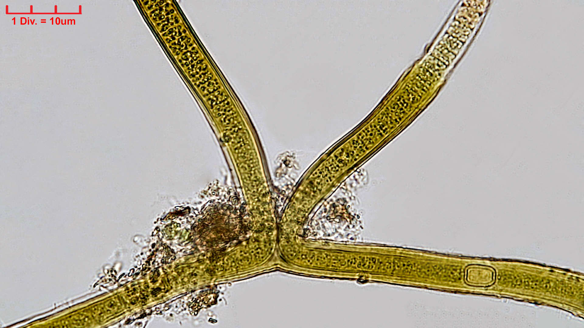 ./Cyanobacteria/Nostocales/Scytonemataceae/Scytonema/tolypothrichoides/scy-tolypothrichoides-404.jpg