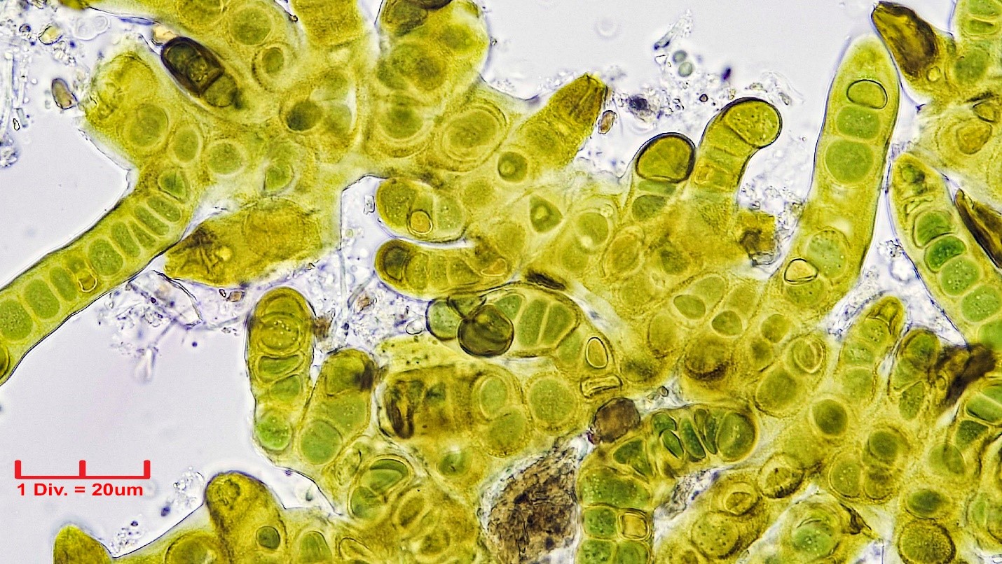 Cyanobacteria/Nostocales/Stigonemataceae/Stigonema/informe/stigonema-informe-519.jpg
