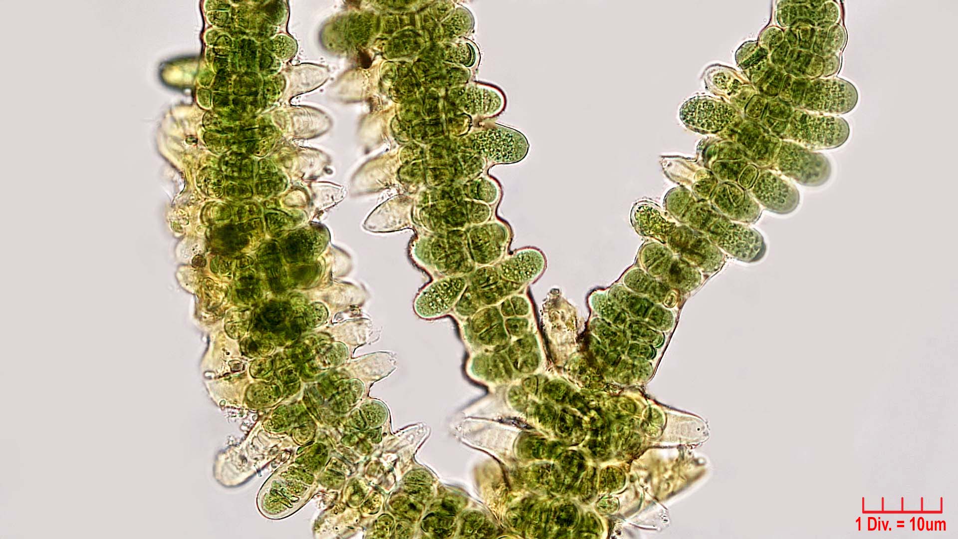 Cyanobacteria/Nostocales/Stigonemataceae/Stigonema/mamillosum/stigonema-mamillosum-540.jpg