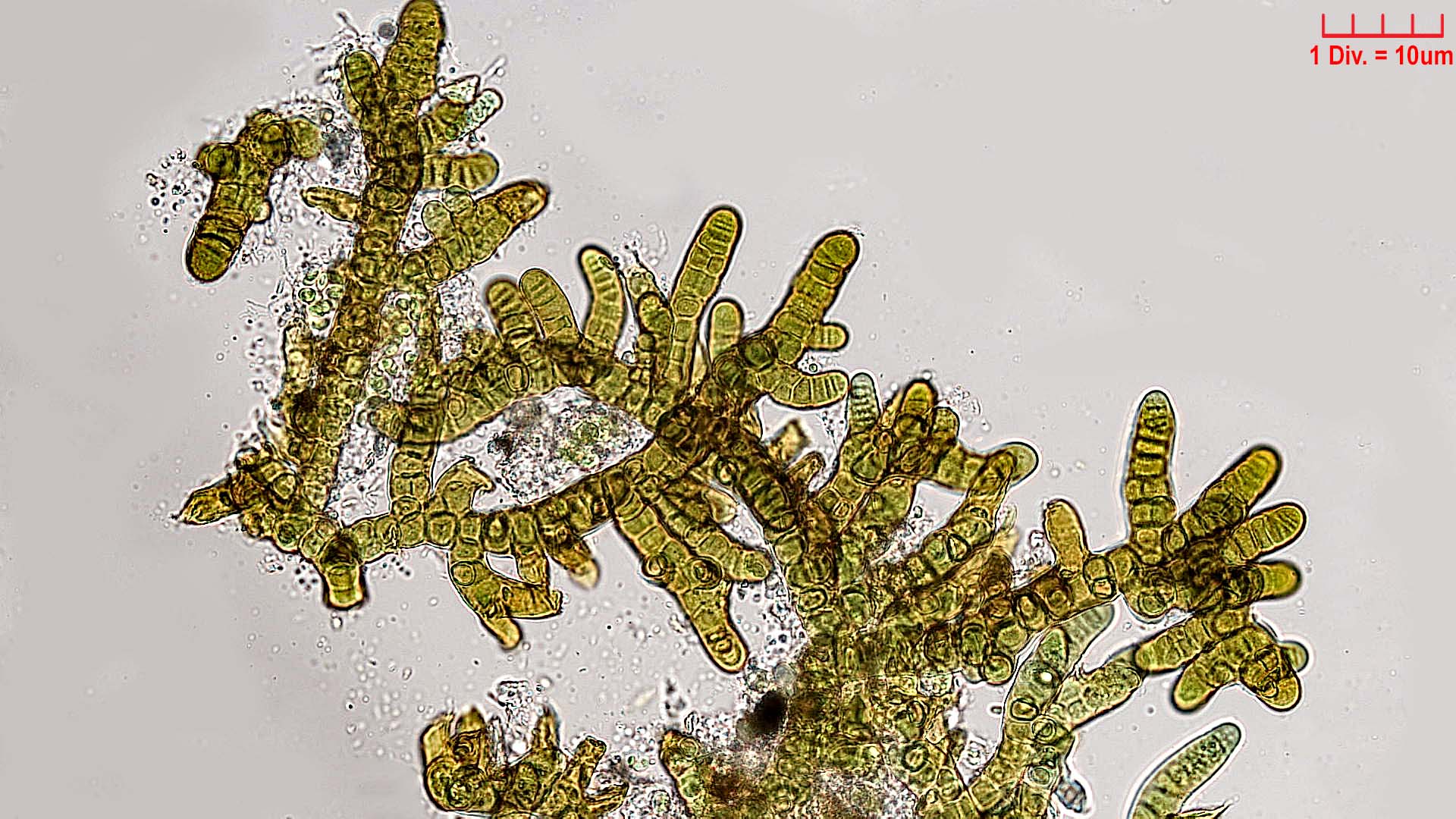 Cyanobacteria/Nostocales/Stigonemataceae/Stigonema/minutum/stigonema-minutum-533.jpg