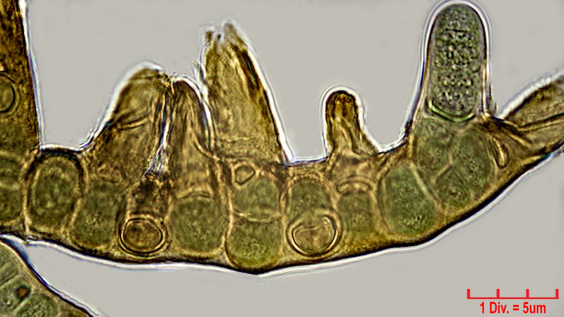 Cyanobacteria/Nostocales/Stigonemataceae/Stigonema/minutum/stigonema-minutum-535.jpg