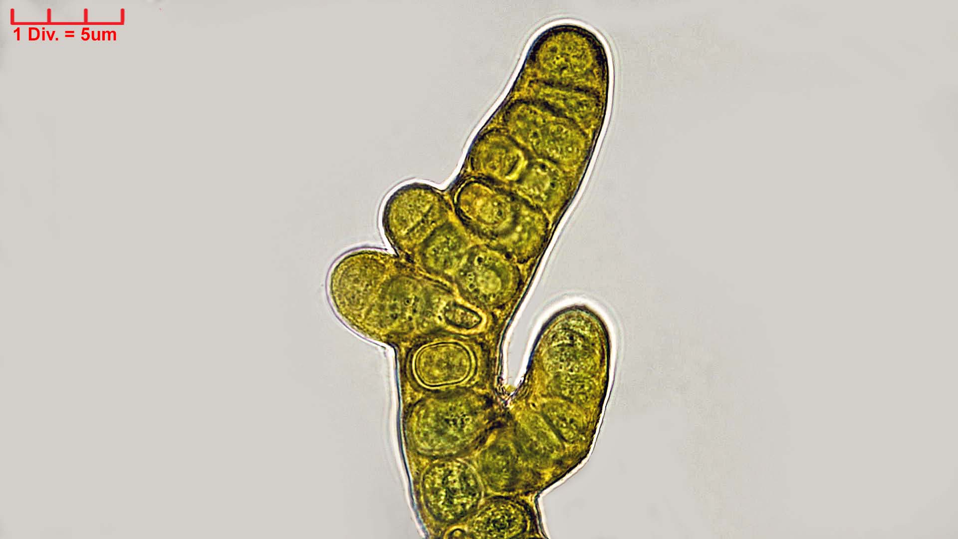 Cyanobacteria/Nostocales/Stigonemataceae/Stigonema/minutum/stigonema-minutum-536.jpg