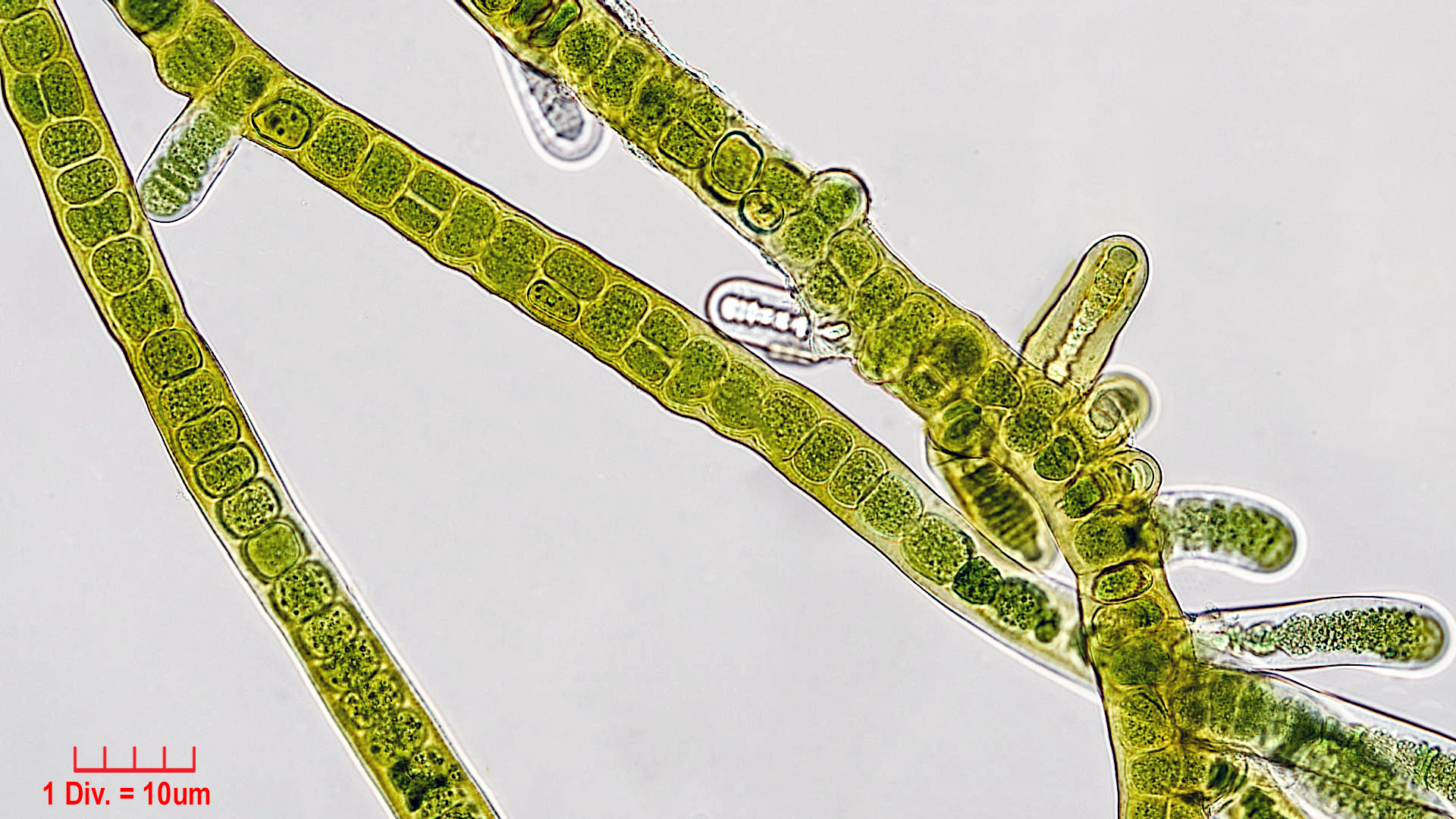 Cyanobacteria/Nostocales/Stigonemataceae/Stigonema/ocellatum/stigonema-ocellatum-1001.jpg