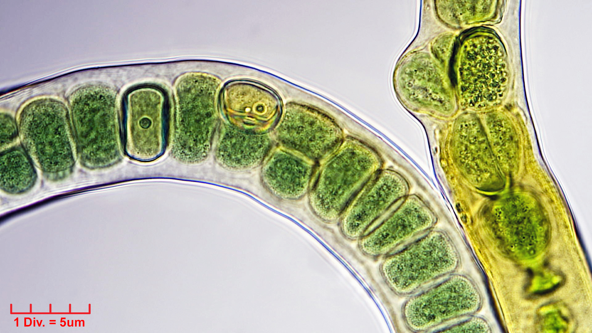 ./Cyanobacteria/Nostocales/Stigonemataceae/Stigonema/ocellatum/stigonema-ocellatum-1002.jpg