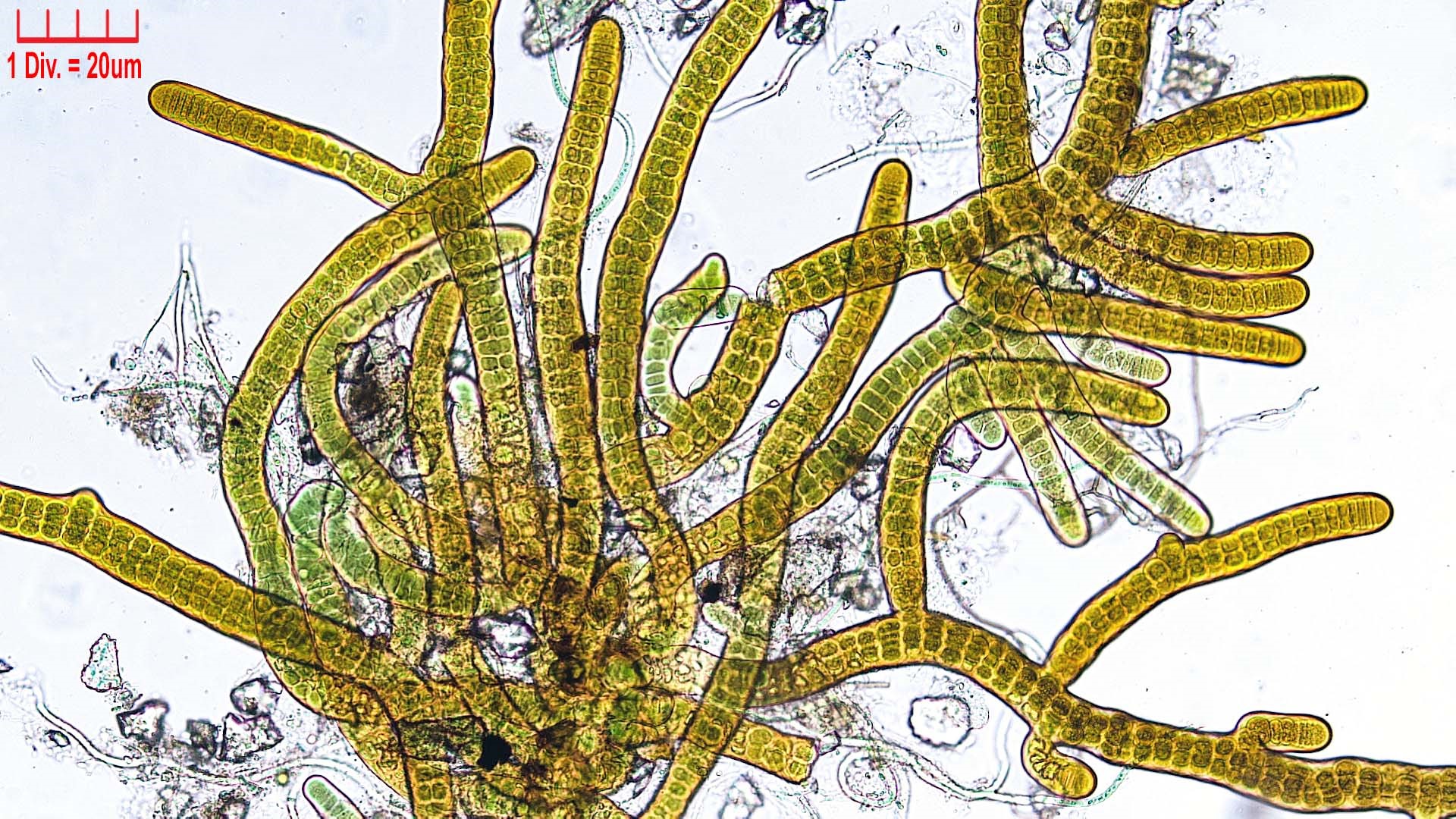 ././Cyanobacteria/Nostocales/Stigonemataceae/Stigonema/turfaceum/stigonema-turfaceum-522.jpg