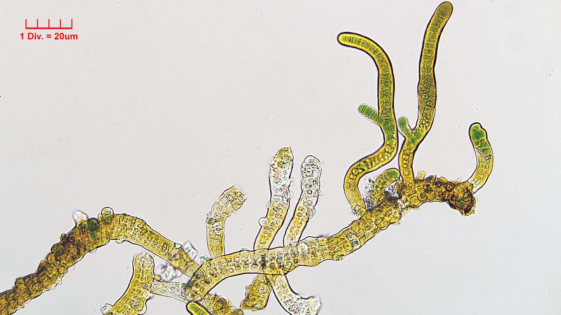 Cyanobacteria/Nostocales/Stigonemataceae/Stigonema/turfaceum/stigonema-turfaceum-523.jpg