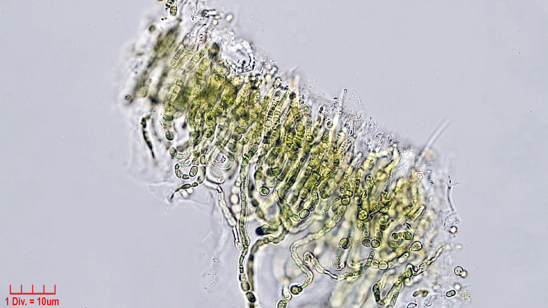 Cyanobacteria/Nostocales/Symphyonemataceae/Brachytrichia/sp/brachytrichia-2.jpg