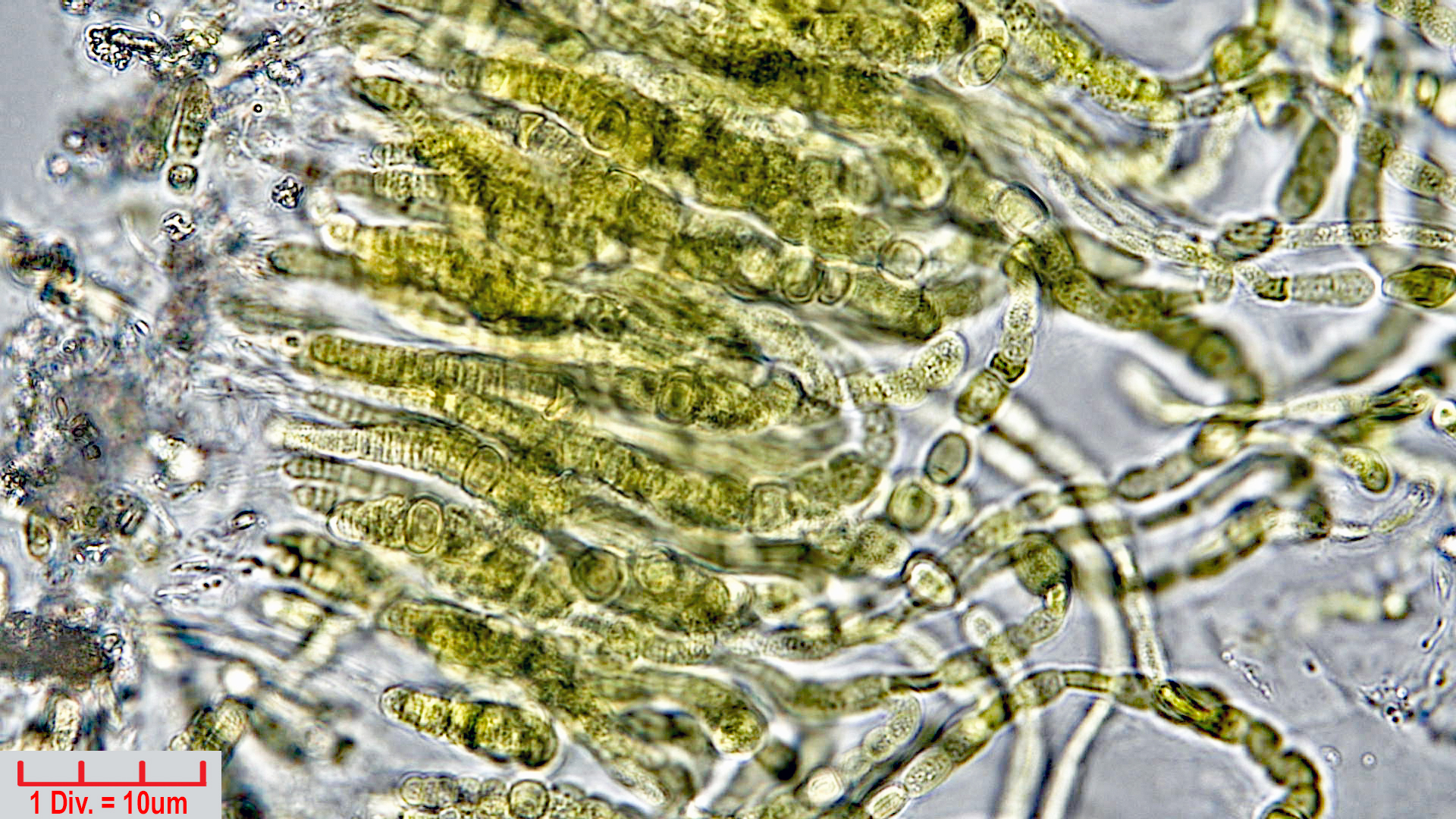 Cyanobacteria/Nostocales/Symphyonemataceae/Brachytrichia/sp/brachytrichia-5.jpg