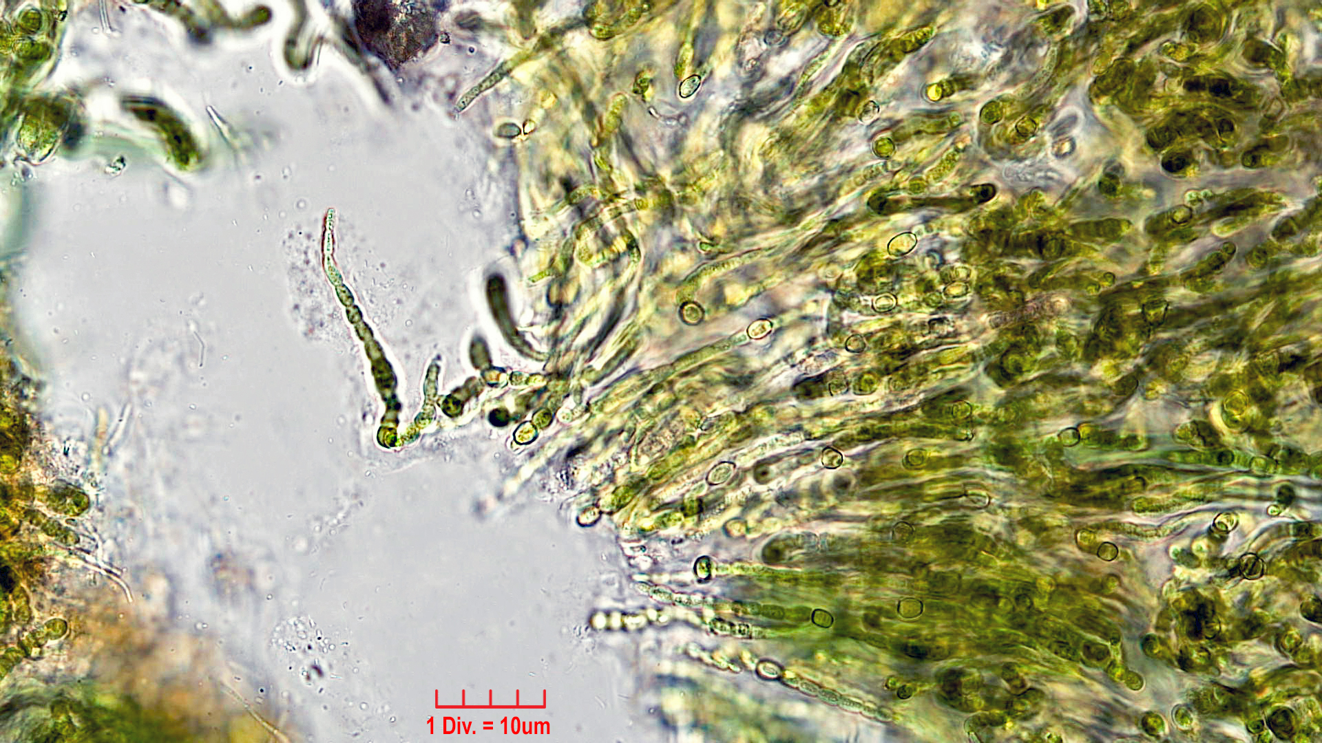 Cyanobacteria/Nostocales/Symphyonemataceae/Brachytrichia/sp/brachytrichia-7.jpg