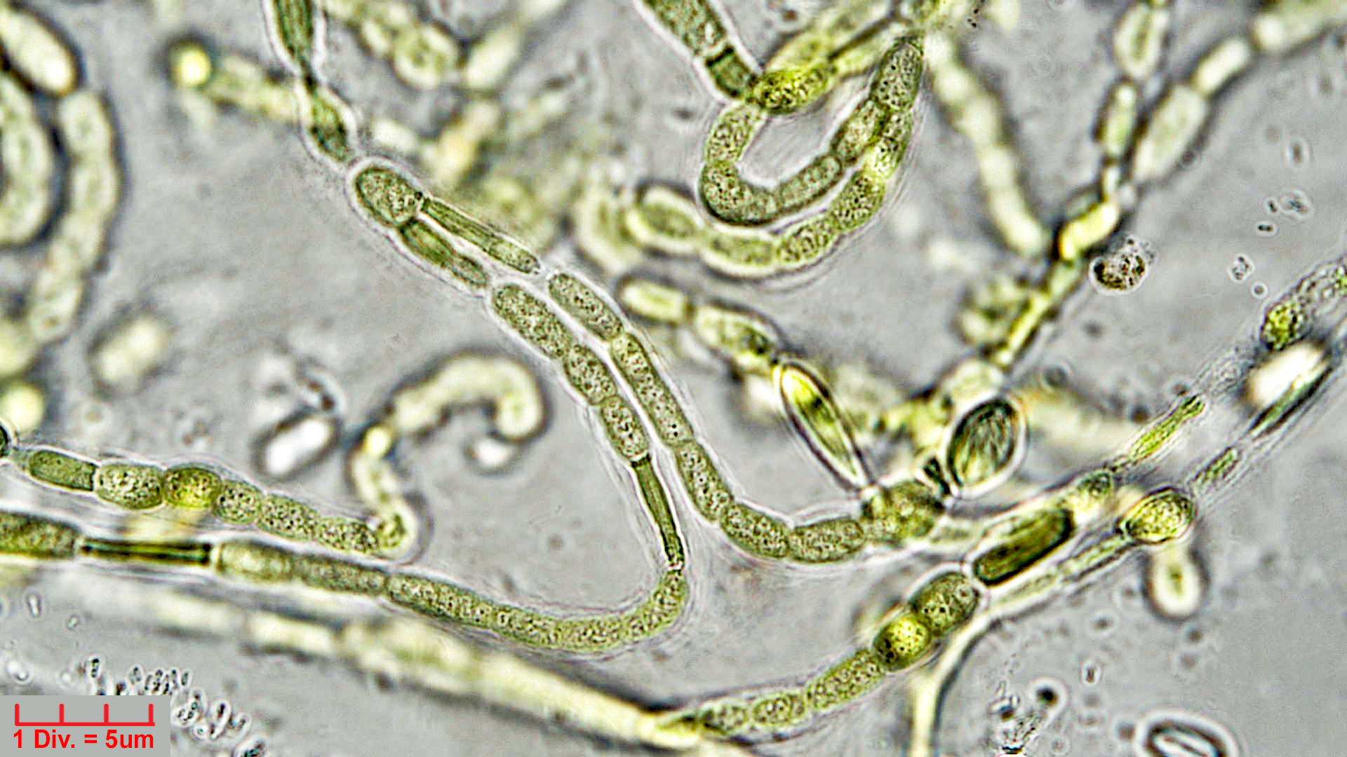 Cyanobacteria/Nostocales/Symphyonemataceae/Brachytrichia/sp/brachytrichia-9.jpg