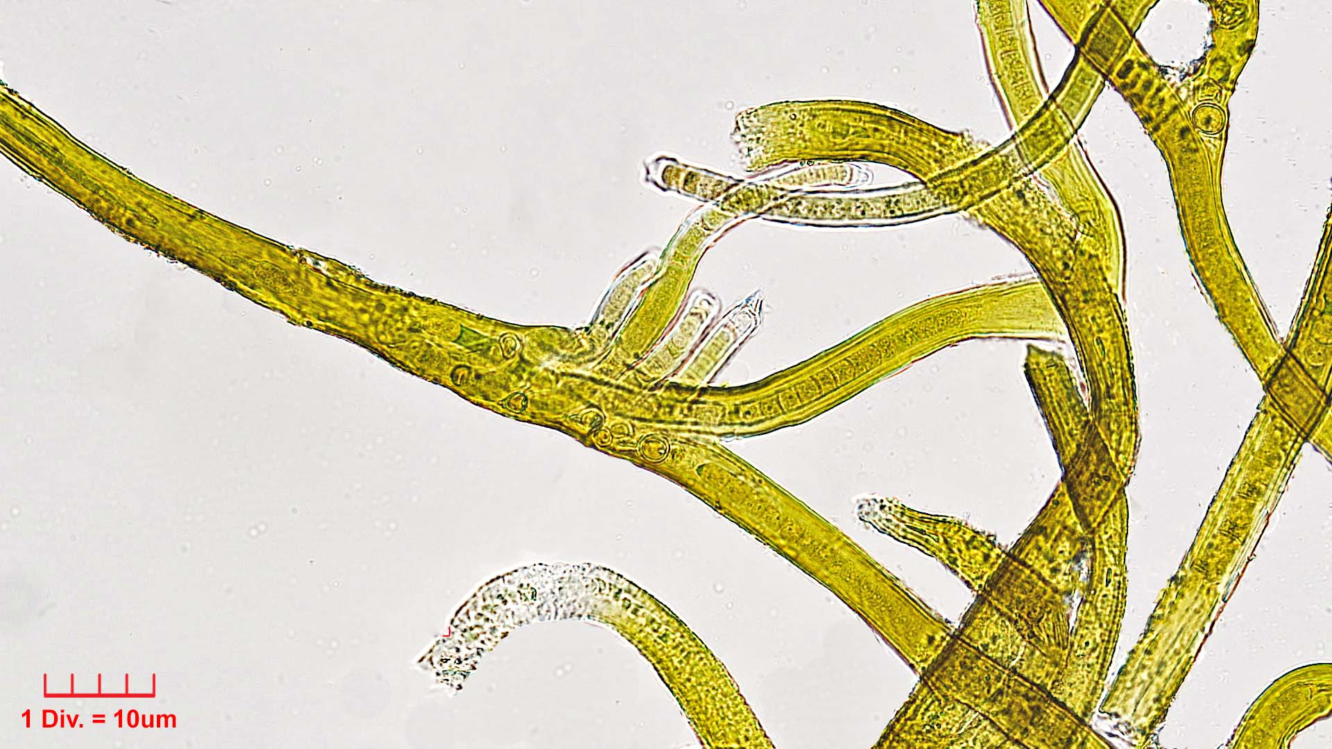Cyanobacteria/Nostocales/Tolypothrichaceae/Coleodesmium/floccosum/coleodesmium-floccosum-330.png