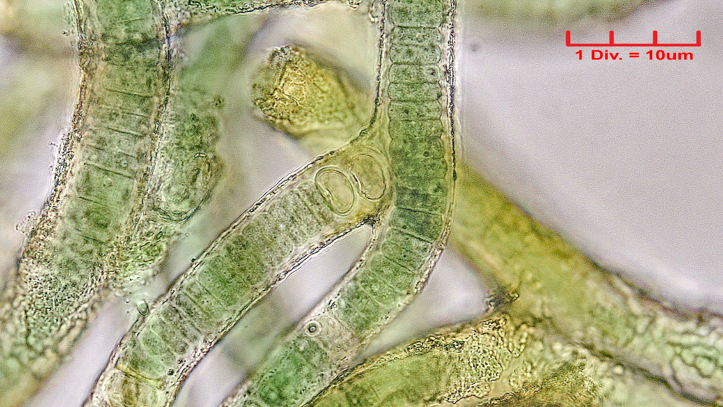 ./././Cyanobacteria/Nostocales/Tolypothrichaceae/Hassalia/byssoidea/hassalia-byssoidea-323.png