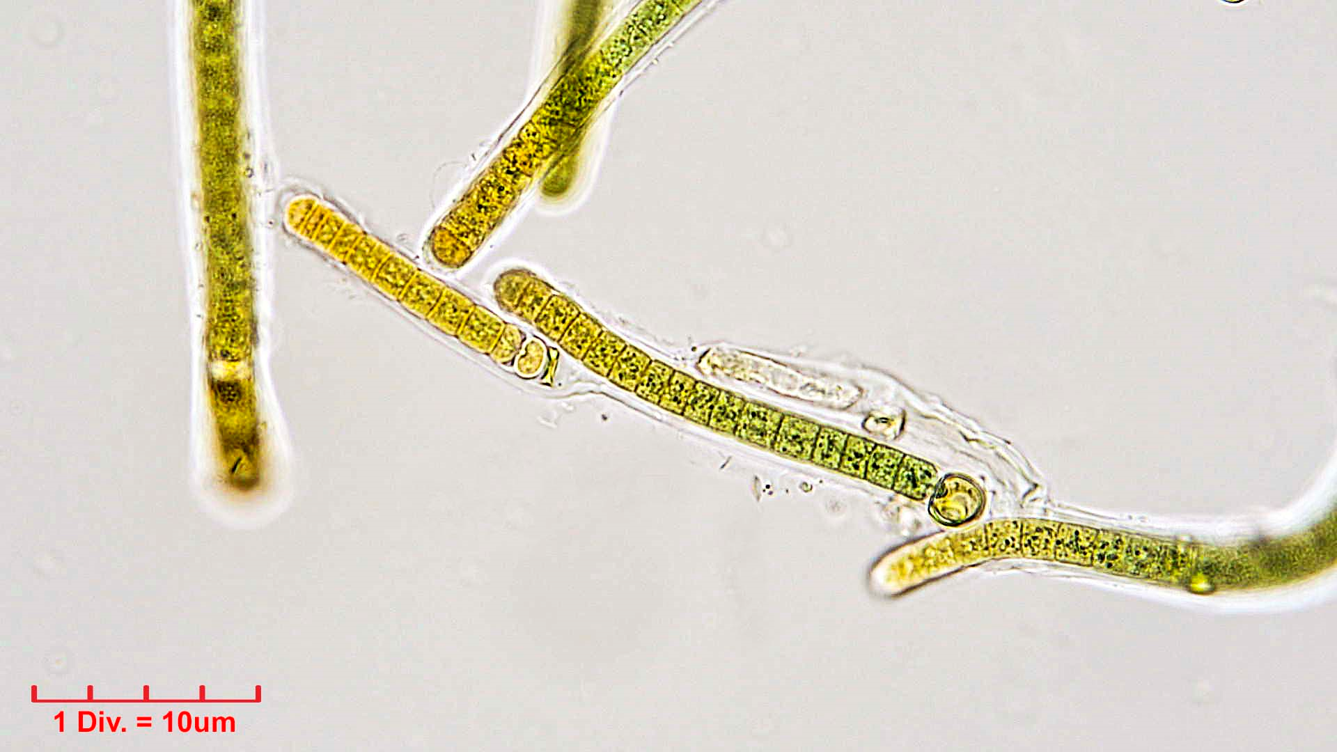 ./././Cyanobacteria/Nostocales/Tolypothrichaceae/Tolypothrix/calcarata/tolypothrix-calcarata-321.png
