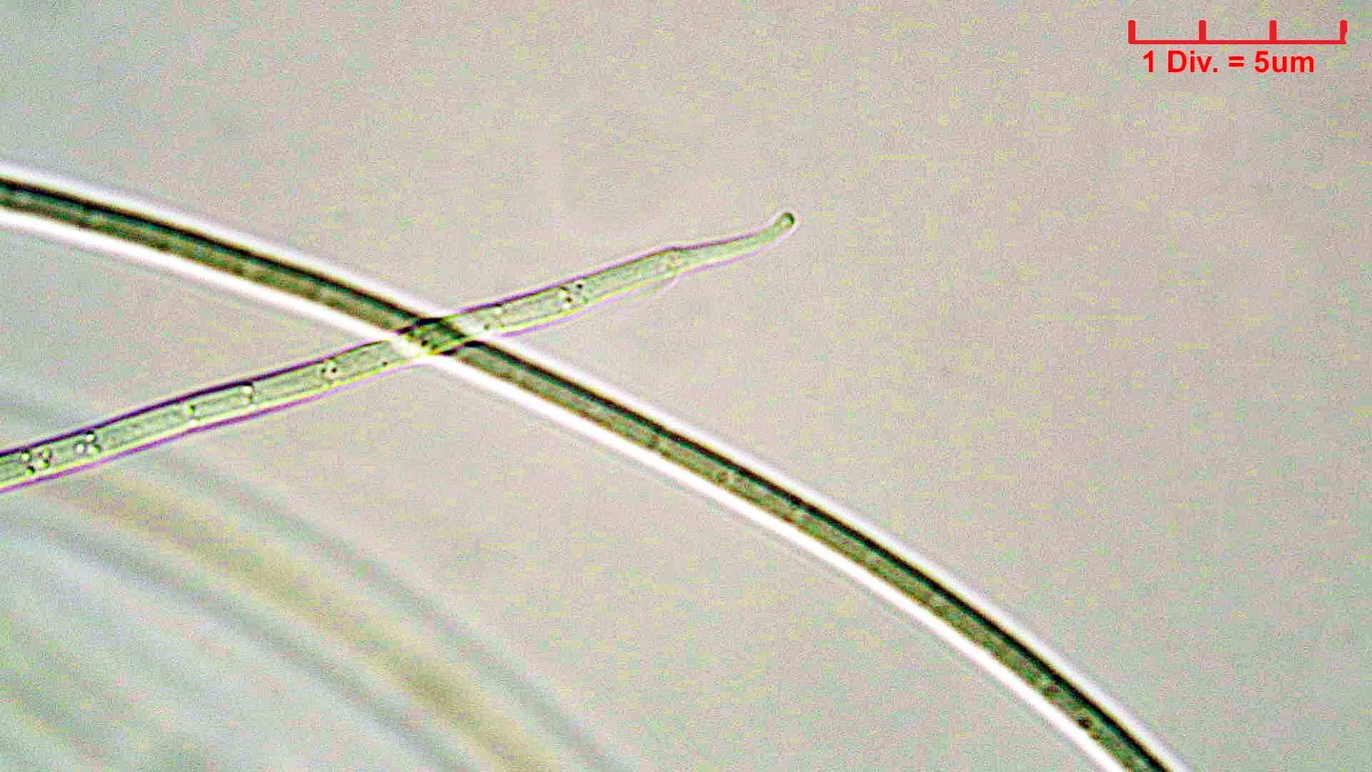 Cyanobacteria/Oscillatoriales/Coleofasciculaceae/Geitlerinema/splendidum/geitlerinema-splendidum-291.jpg