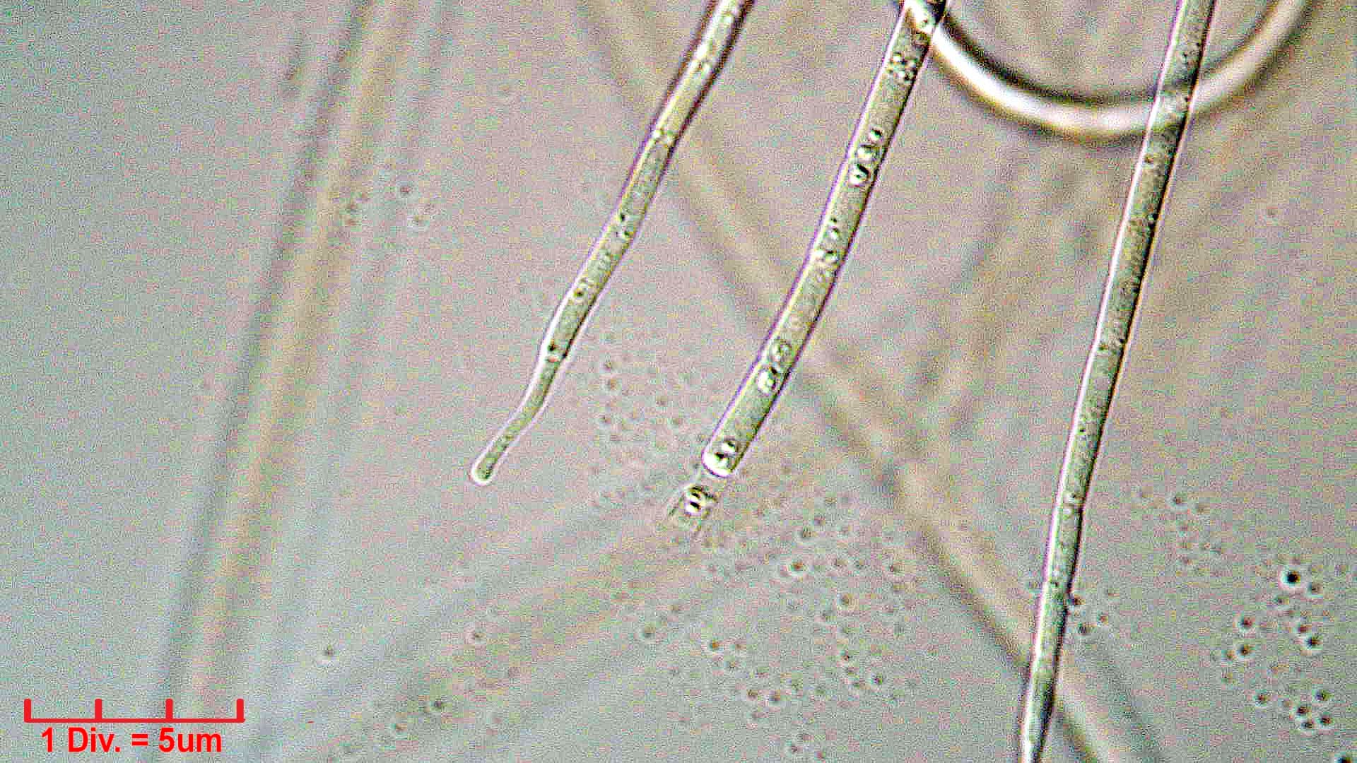 Cyanobacteria/Oscillatoriales/Coleofasciculaceae/Geitlerinema/splendidum/geitlerinema-splendidum-294.jpg