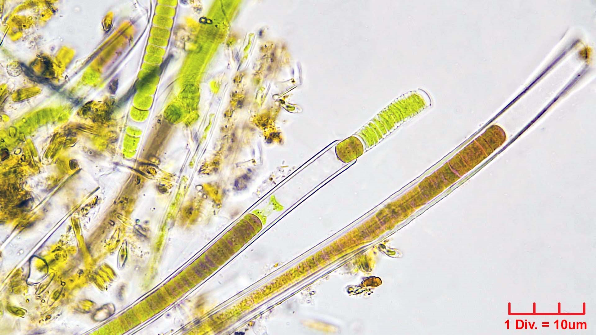 Cyanobacteria/Oscillatoriales/Homeotrichaceae/Homeothrix/juliana/homeothrix-juliana-300.jpg