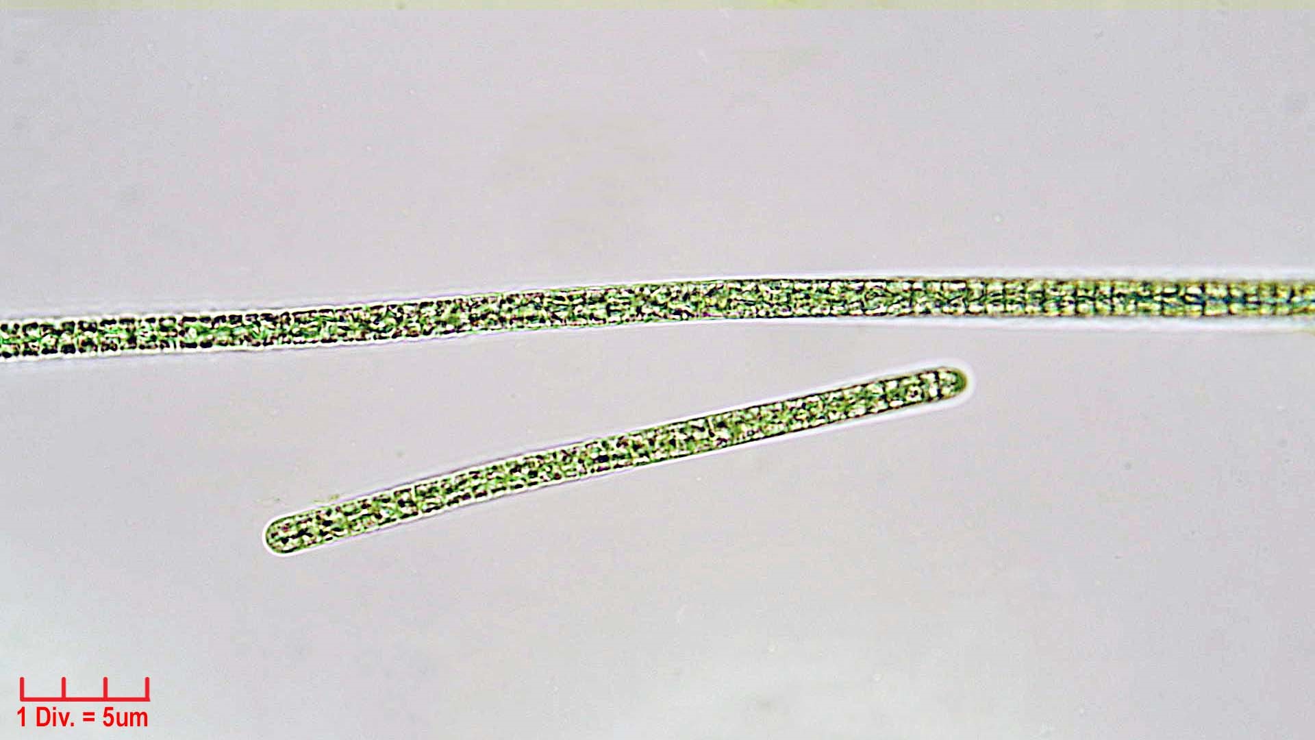 Cyanobacteria/Oscillatoriales/Microcoleaceae/Planktothrix/agardhii/planktothrix-agardhii-246.jpg