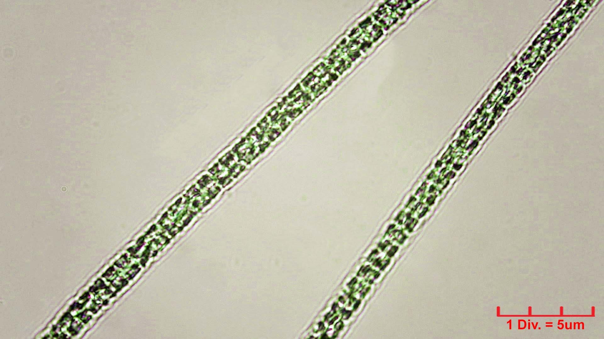 Cyanobacteria/Oscillatoriales/Microcoleaceae/Planktothrix/agardhii/planktothrix-agardhii-248.jpg