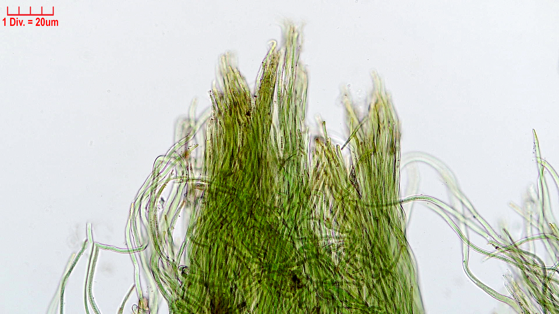 Cyanobacteria/Oscillatoriales/Microcoleaceae/Symplocastrum/friesii/symplocastrum-friesii-1.jpg