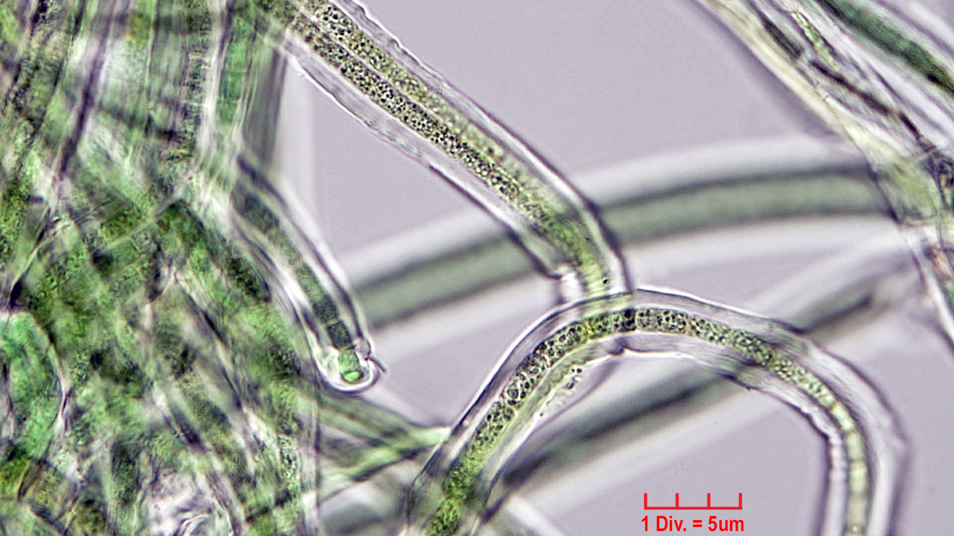 Cyanobacteria/Oscillatoriales/Microcoleaceae/Symplocastrum/friesii/symplocastrum-friesii-2.jpg