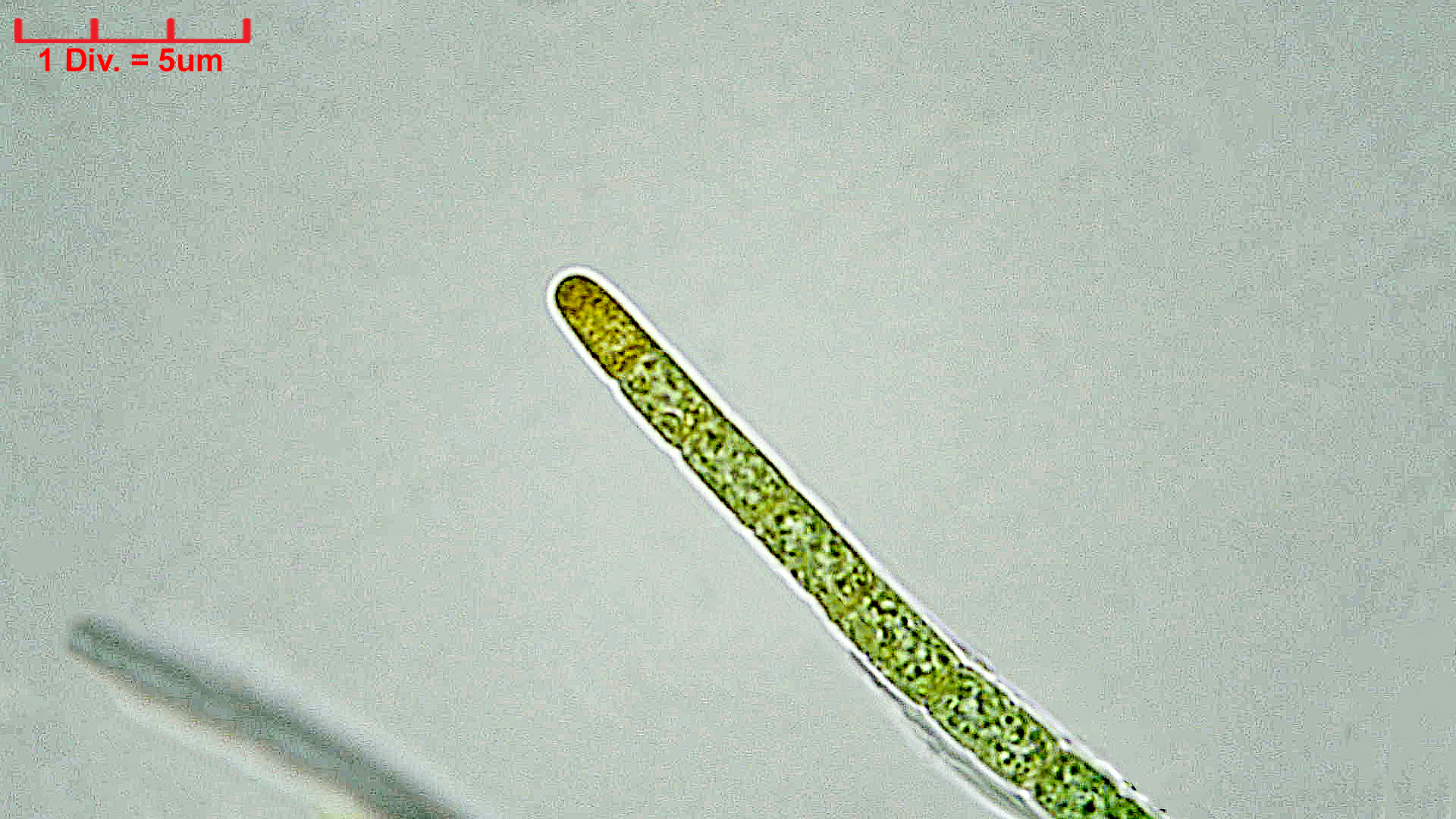 ./Cyanobacteria/Oscillatoriales/Microcoleaceae/Symplocastrum/friesii/symplocastrum-friesii-4.jpg