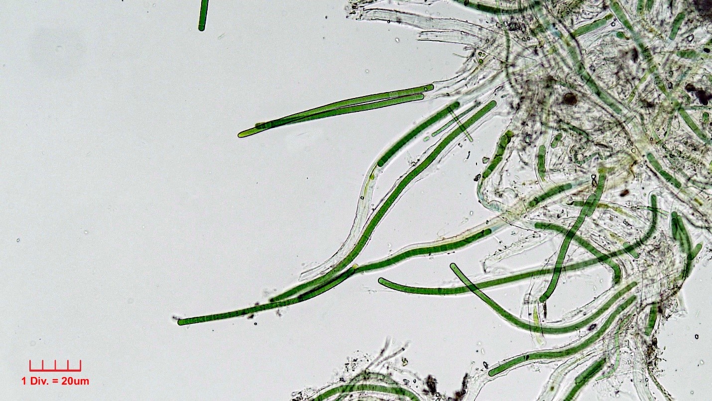 ./Cyanobacteria/Oscillatoriales/Microcoleaceae/Symplocastrum/muelleri/symplocastrum-muelleri-276.jpg