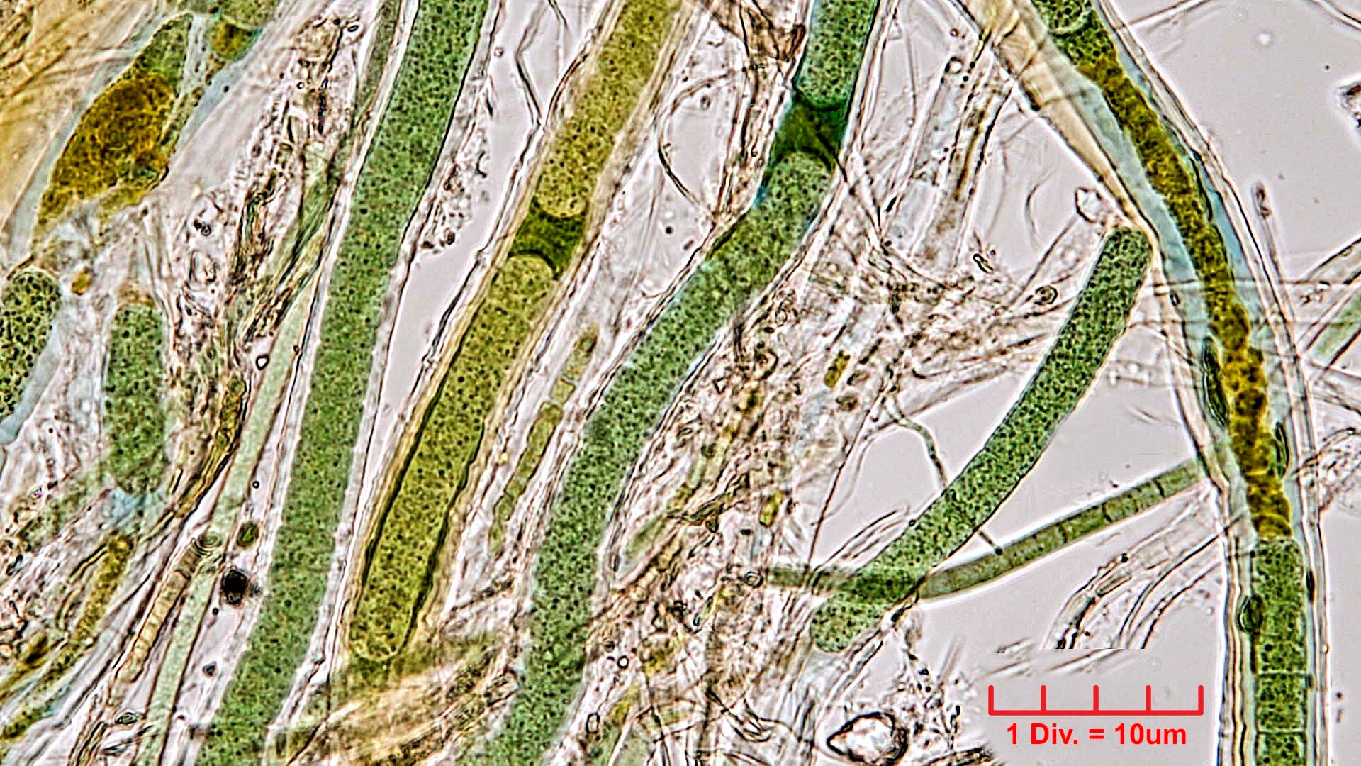 ./Cyanobacteria/Oscillatoriales/Microcoleaceae/Symplocastrum/muelleri/symplocastrum-muelleri-278.jpg