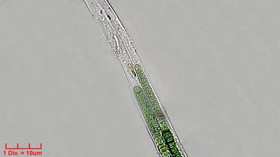 Cyanobacteria/Oscillatoriales/Oscillatoriaceae/Blenothrix/sp/blenothrix-211.png