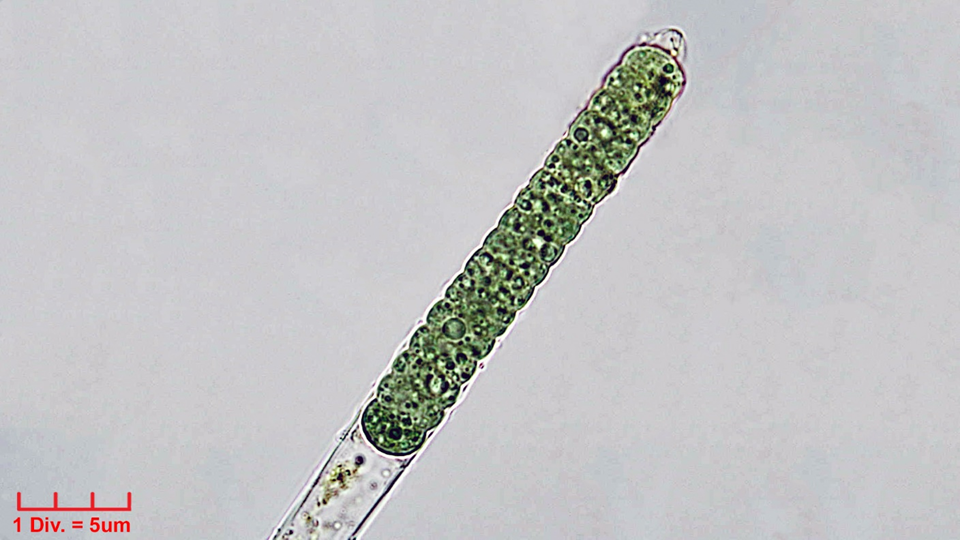 ./Cyanobacteria/Oscillatoriales/Oscillatoriaceae/Blenothrix/sp/blenothrix-219.png