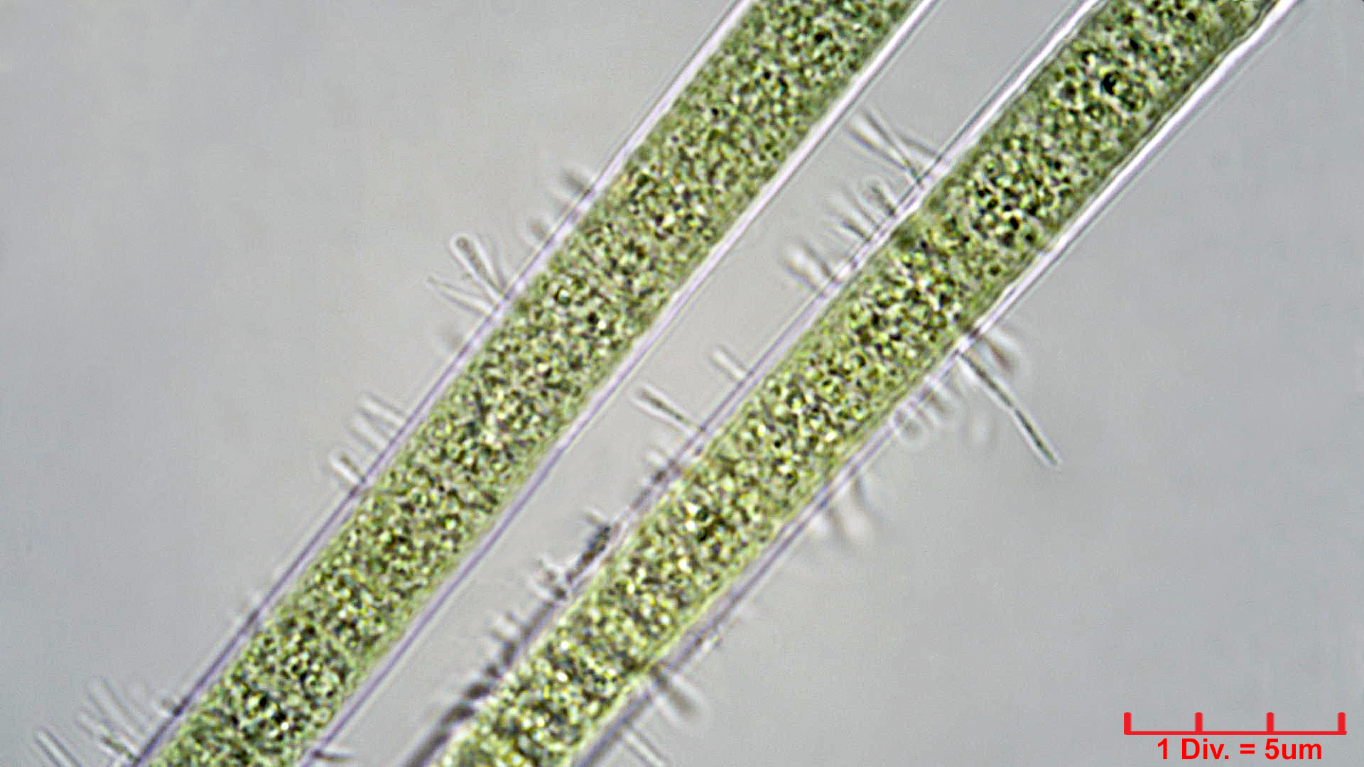 ./Cyanobacteria/Oscillatoriales/Oscillatoriaceae/Lyngbya/semiplena/lyngbya-semiplena-4.jpg