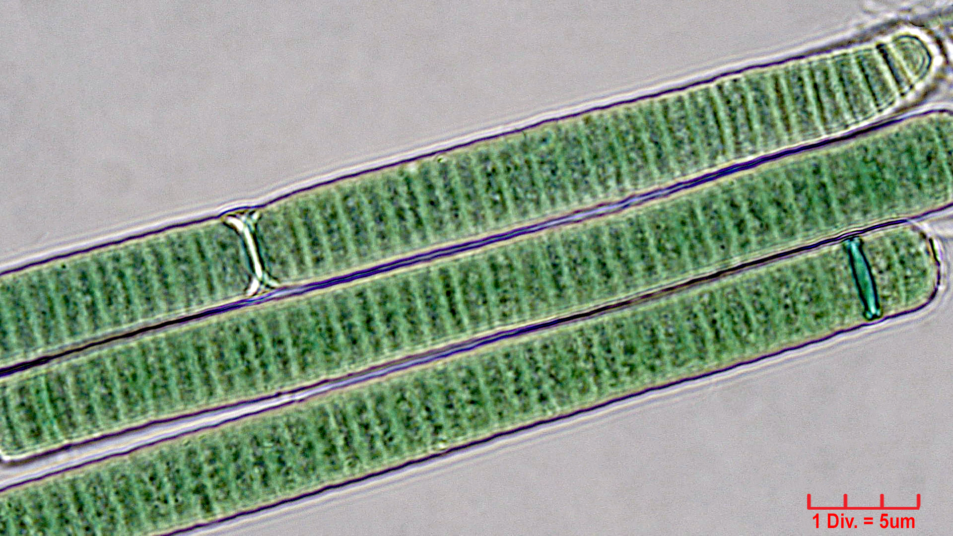./Cyanobacteria/Oscillatoriales/Oscillatoriaceae/Oscillatoria/curviceps/oscillatoria-curviceps-181.jpg