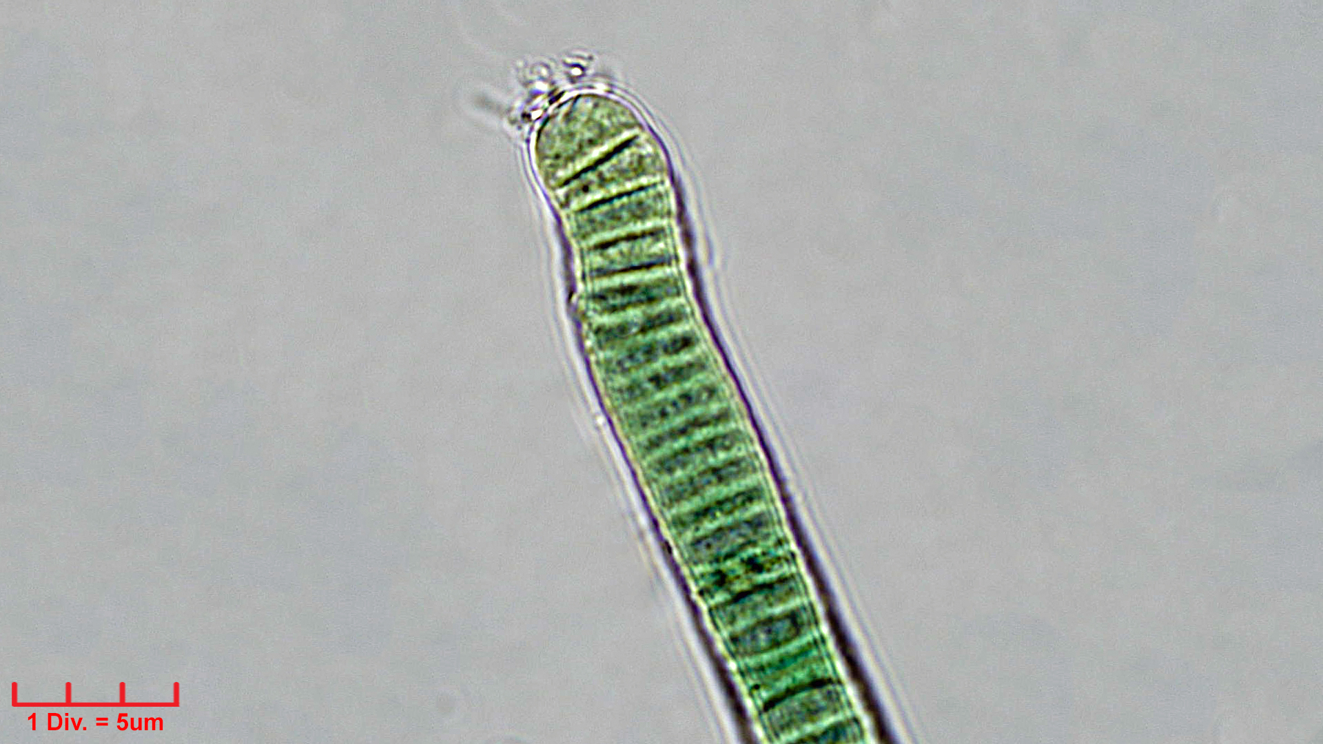 ./Cyanobacteria/Oscillatoriales/Oscillatoriaceae/Oscillatoria/curviceps/oscillatoria-curviceps-183.jpg