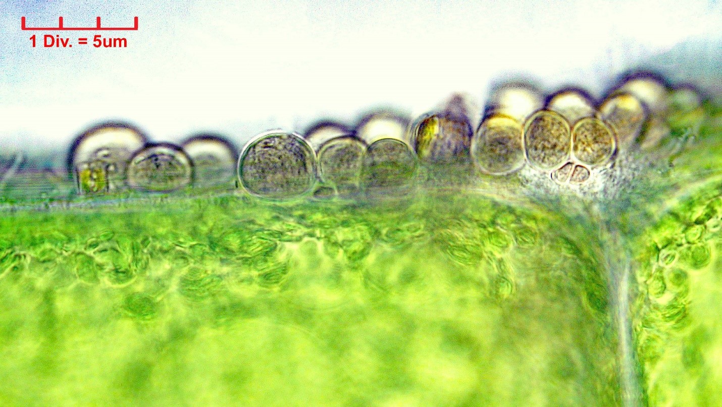 ./Cyanobacteria/Pleurocapsales/Dermocarpellaceae/Cyanocystis/hemisphaerica/cyanocystis-hemisphaerica-157.jpg