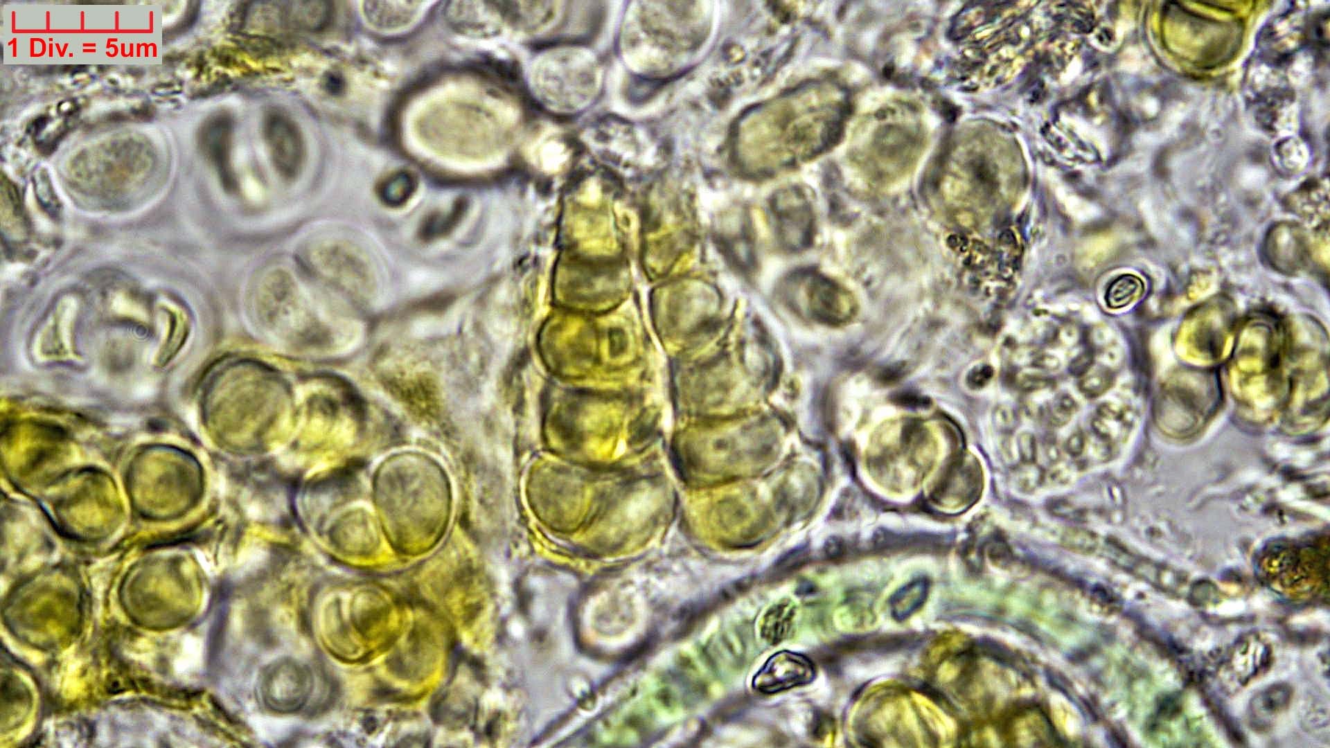 ./Cyanobacteria/Pleurocapsales/Hyellaceae/Pleurocapsa/fuliginosa/pleurocapsa-fuliginosa-164.jpg