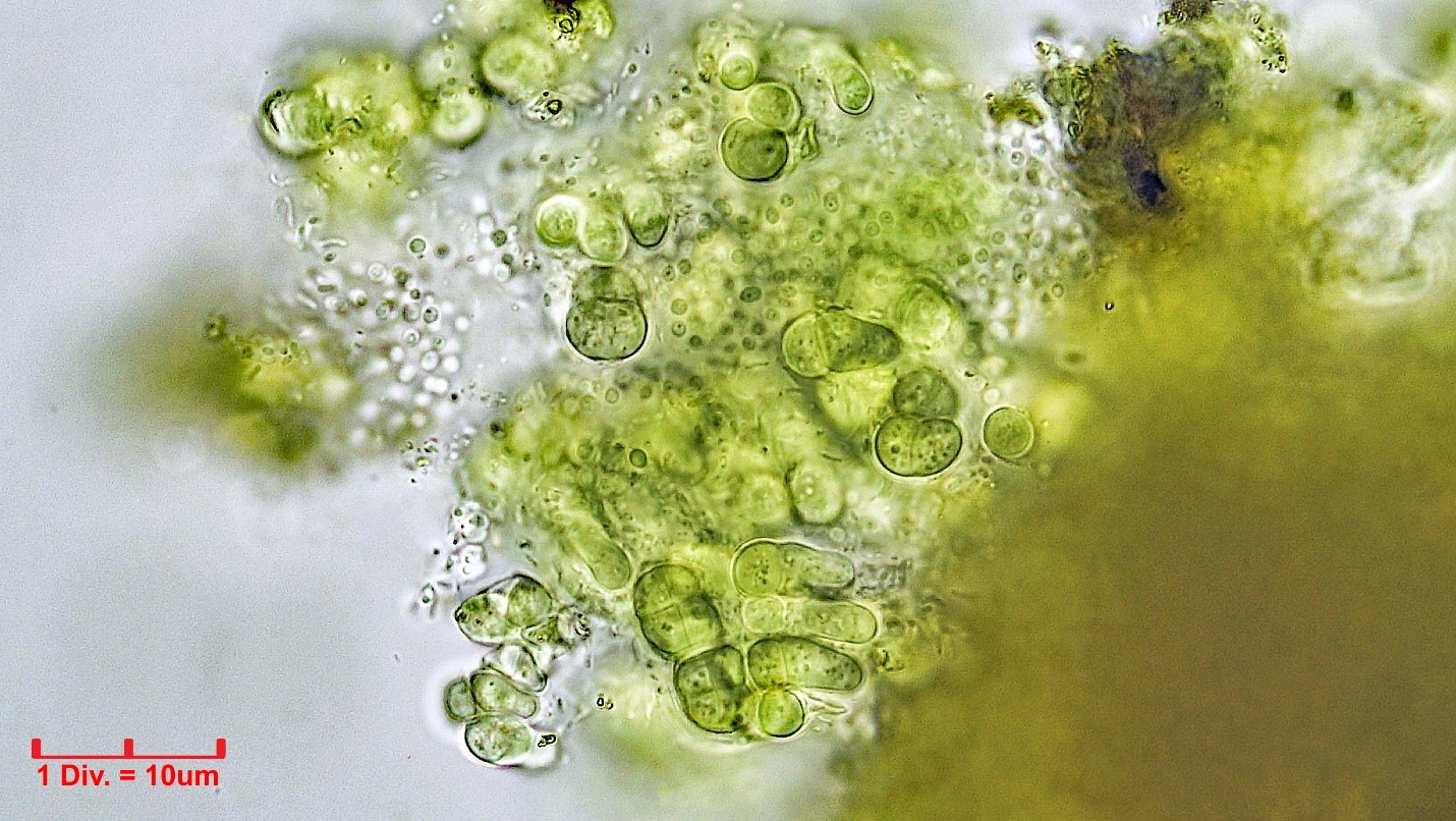 ./Cyanobacteria/Pleurocapsales/Hyellaceae/Pleurocapsa/sp/pleurocapsa-159.jpg
