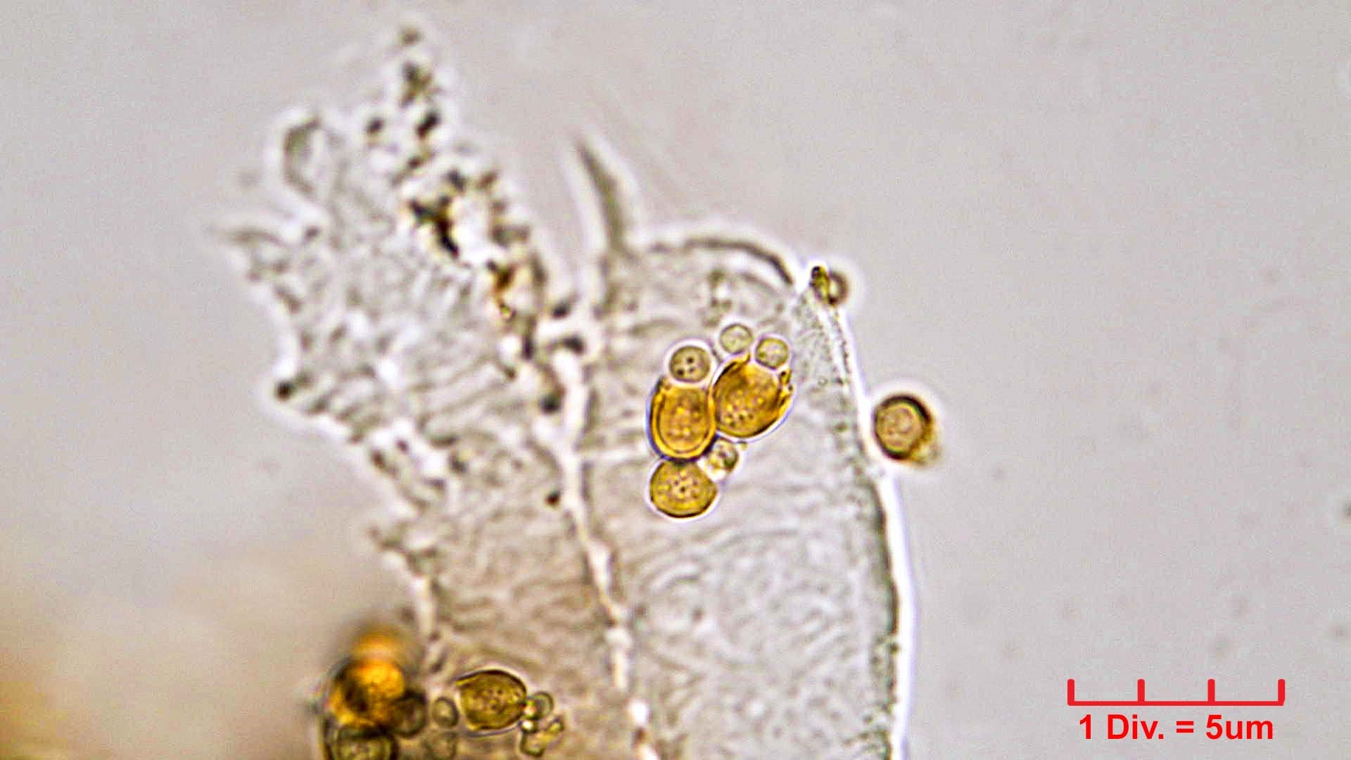 Cyanobacteria/Synechococcales/Chamaesiphonaceae/Chamaesiphon/polonicus/chamaesiphon-polonicus-63.jpg