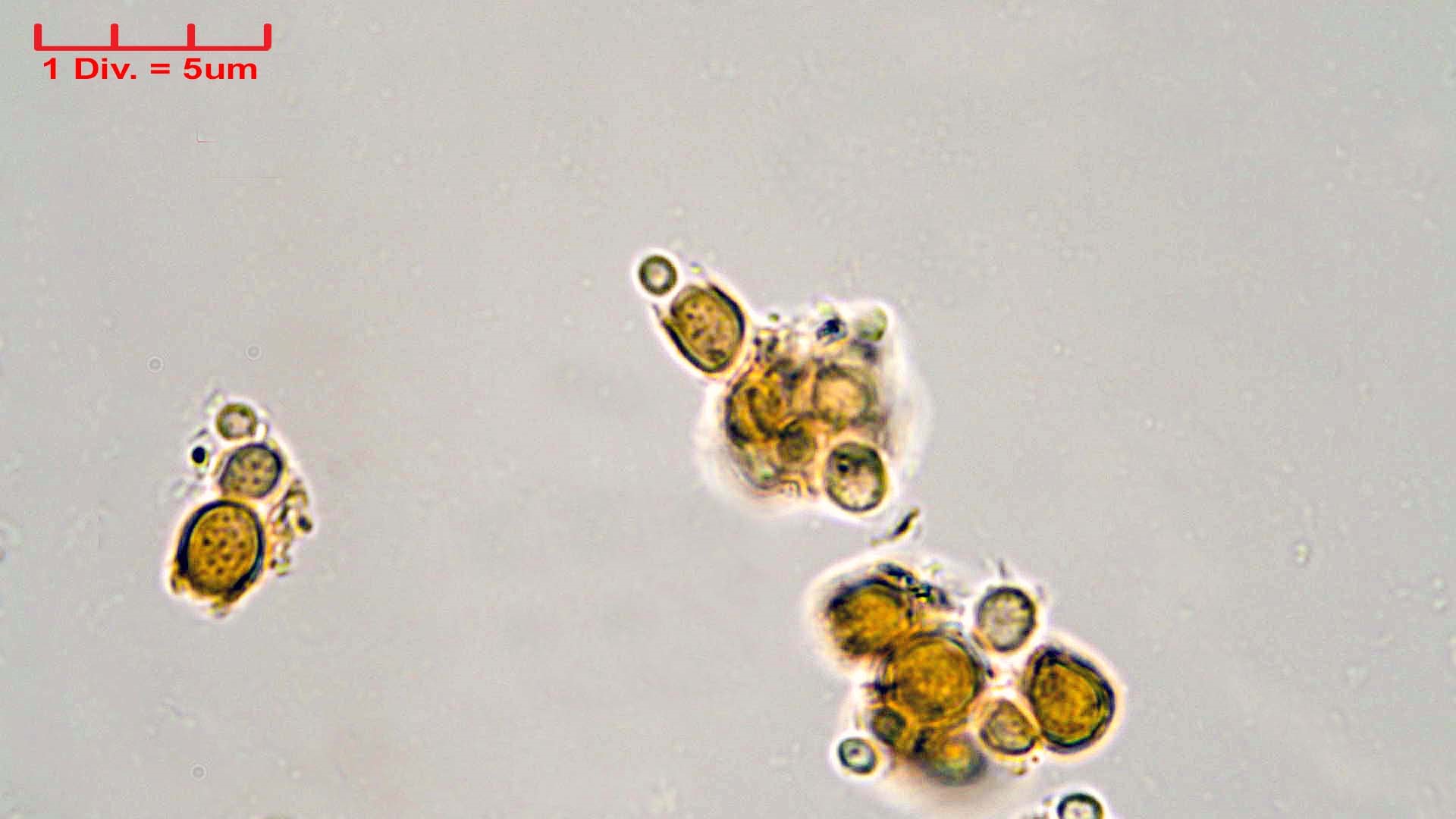 Cyanobacteria/Synechococcales/Chamaesiphonaceae/Chamaesiphon/polonicus/chamaesiphon-polonicus-64.jpg