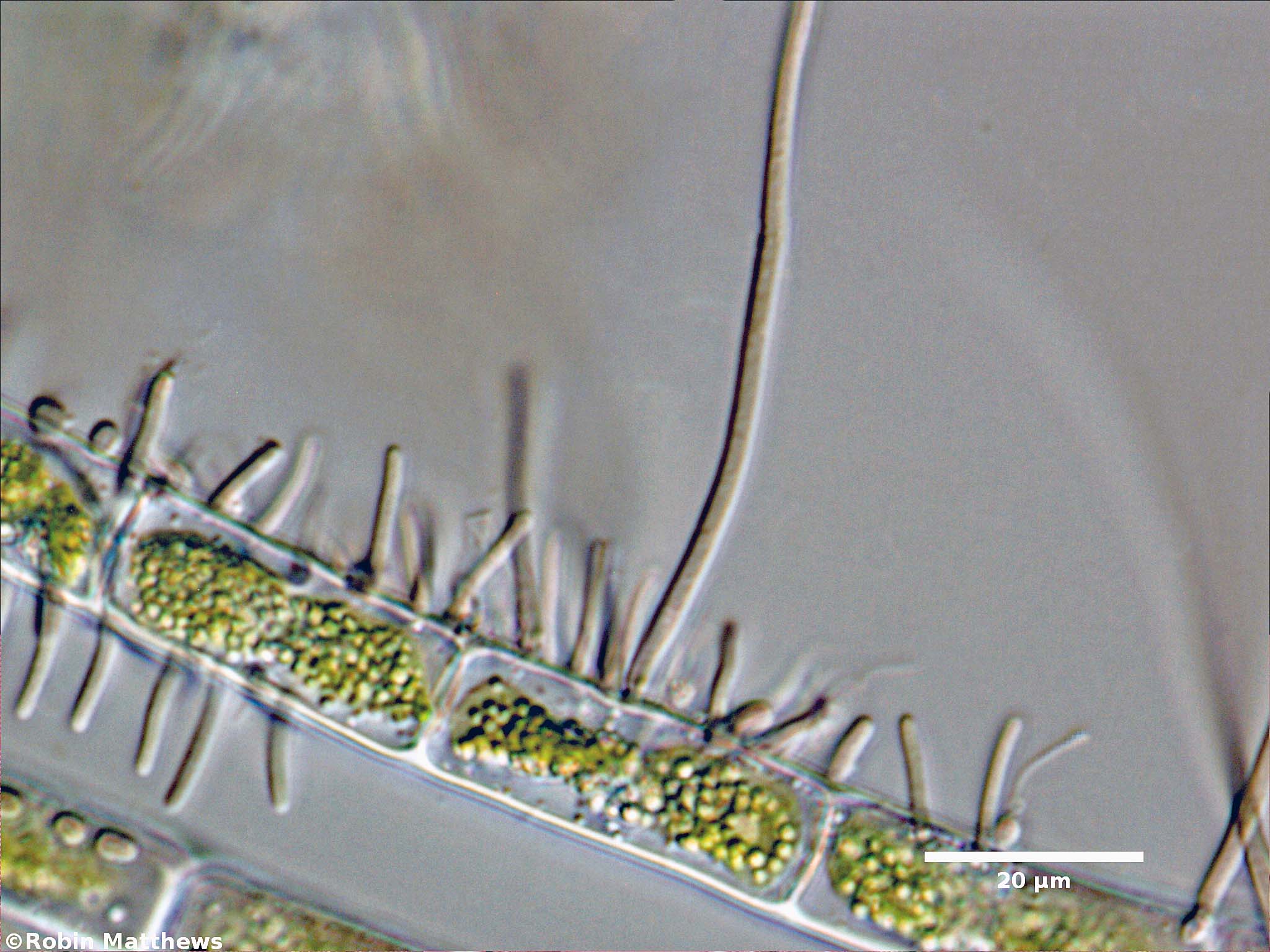 ./././Cyanobacteria/Synechococcales/Chamaesiphonaceae/Cyanophanon/mirable/cyanophanon-mirable-91.jpg