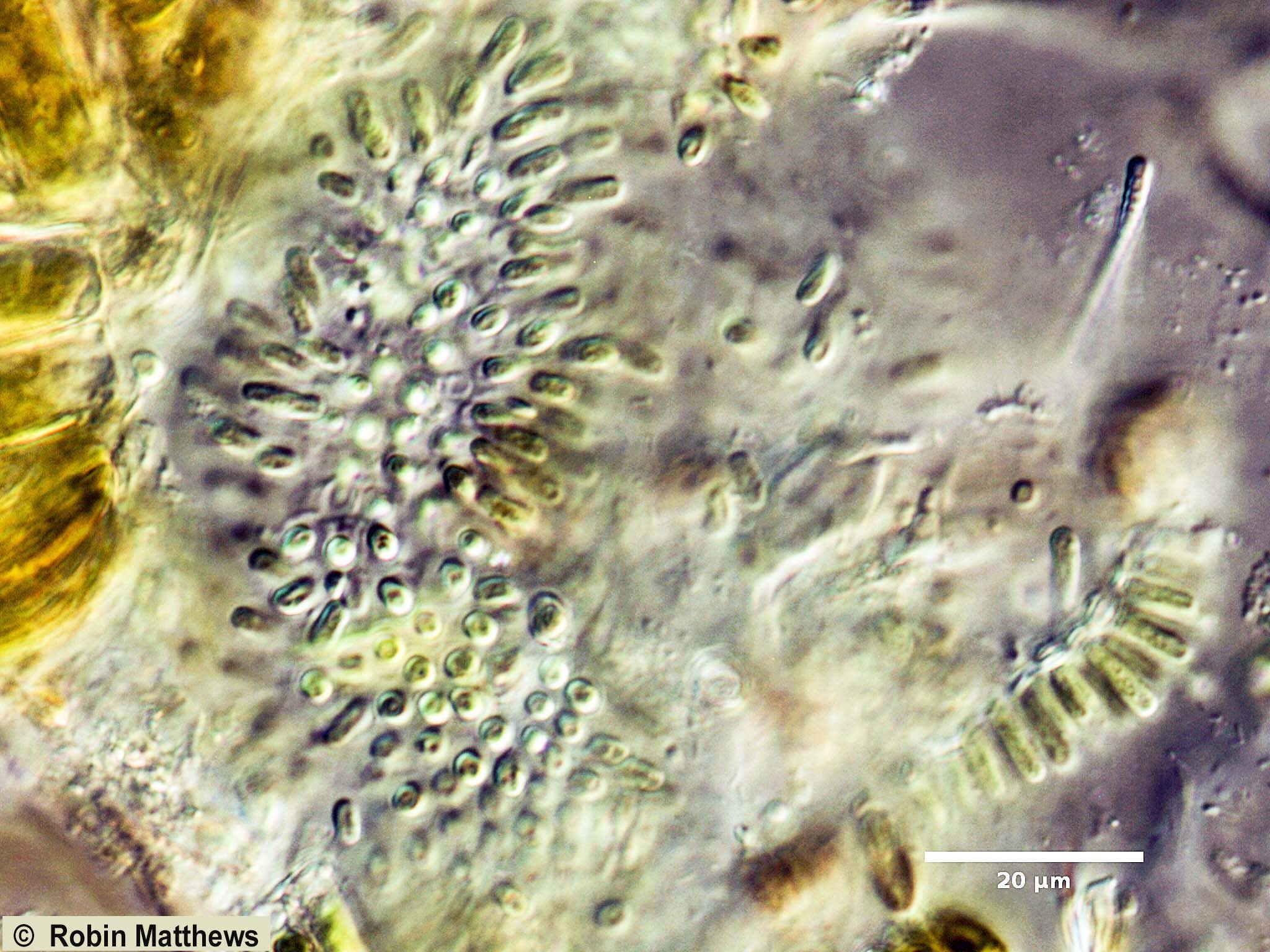././././Cyanobacteria/Synechococcales/Chamaesiphonaceae/Geitlerbactron/periphyticum/geitlerbactron-periphyticum-92.jpg