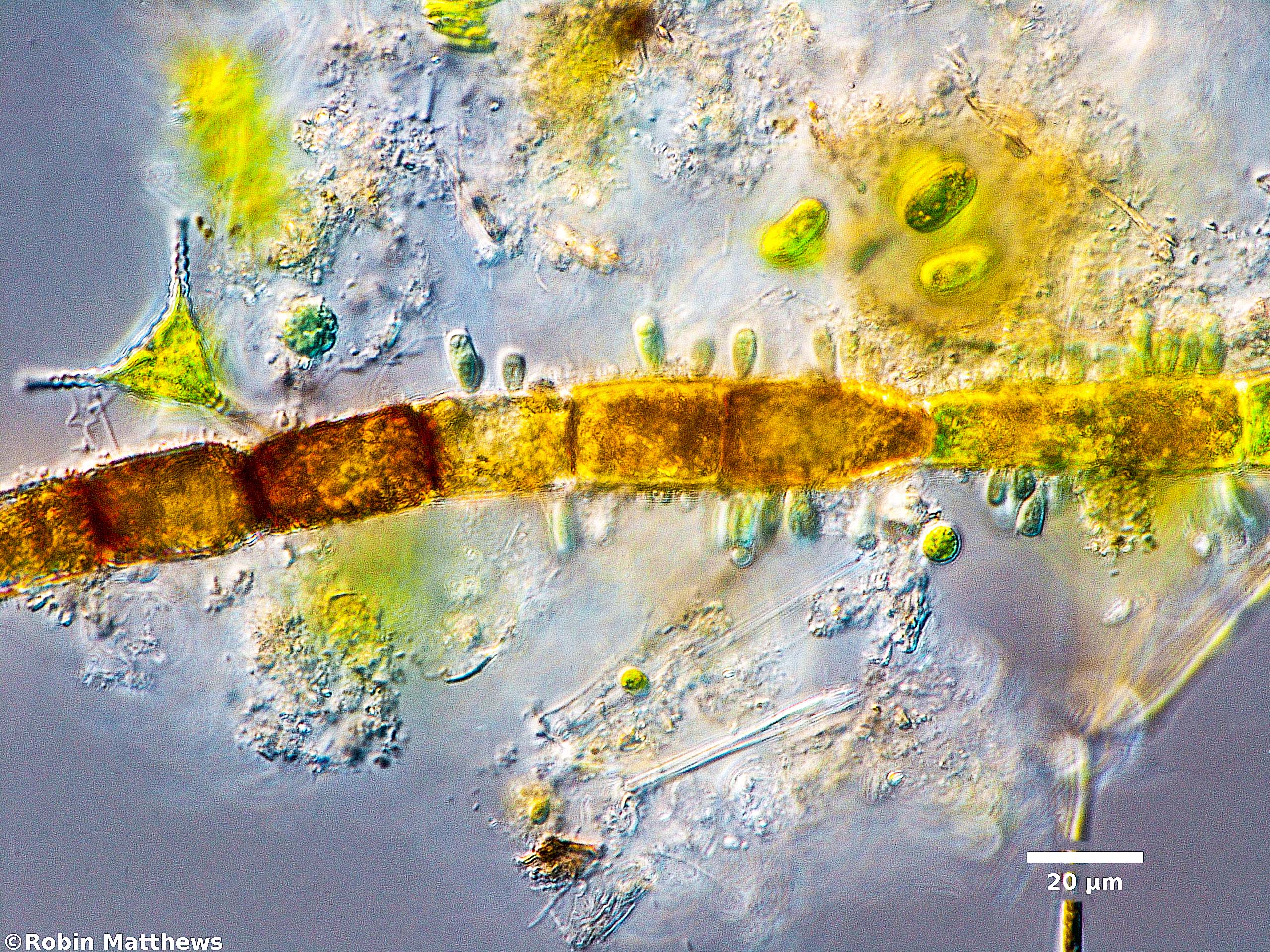 Cyanobacteria/Synechococcales/Chamaesiphonaceae/Geitlerbactron/periphyticum/geitlerbactron-periphyticum-93.jpg