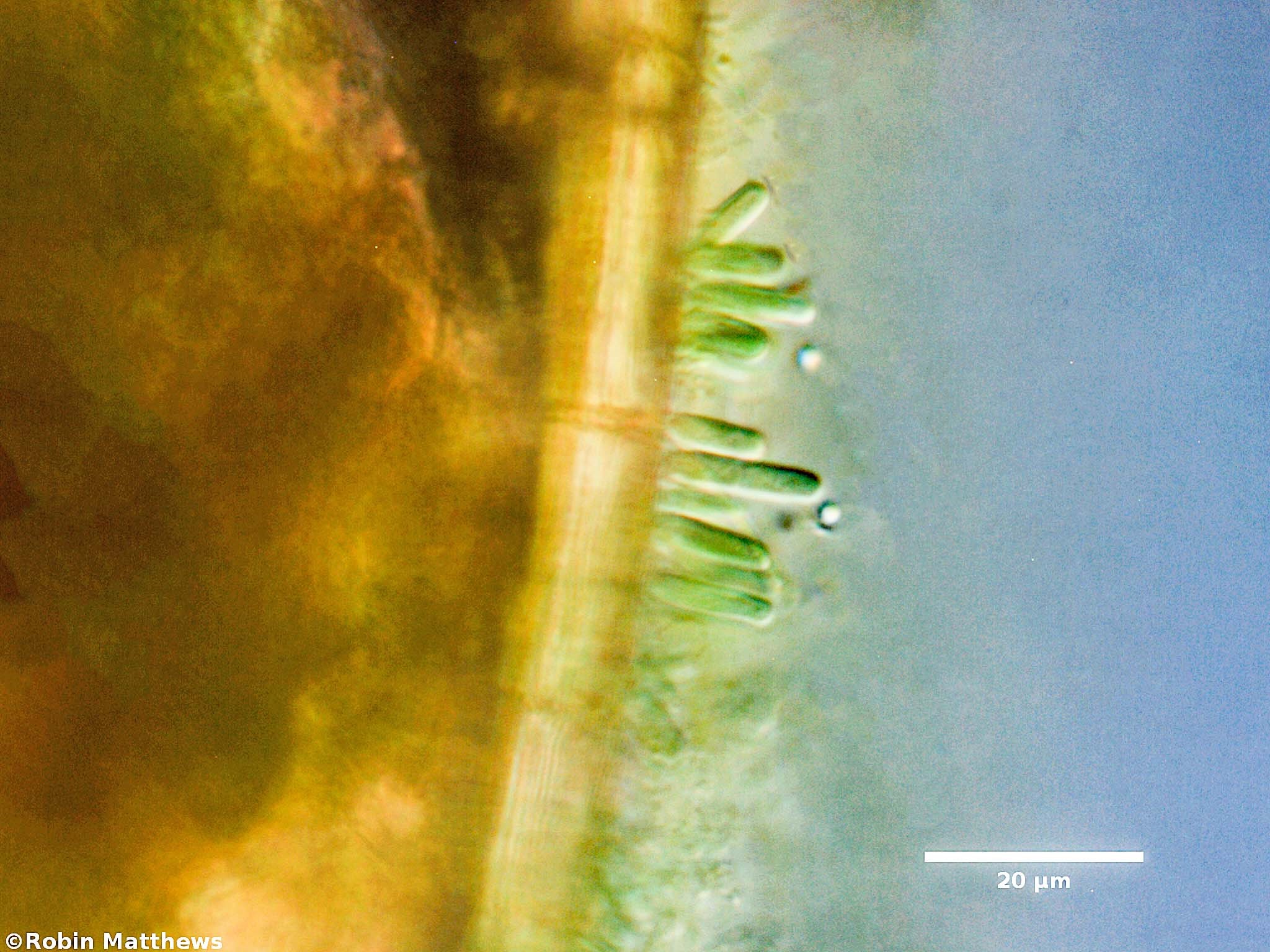 ././././Cyanobacteria/Synechococcales/Chamaesiphonaceae/Geitlerbactron/periphyticum/geitlerbactron-periphyticum-97.jpg