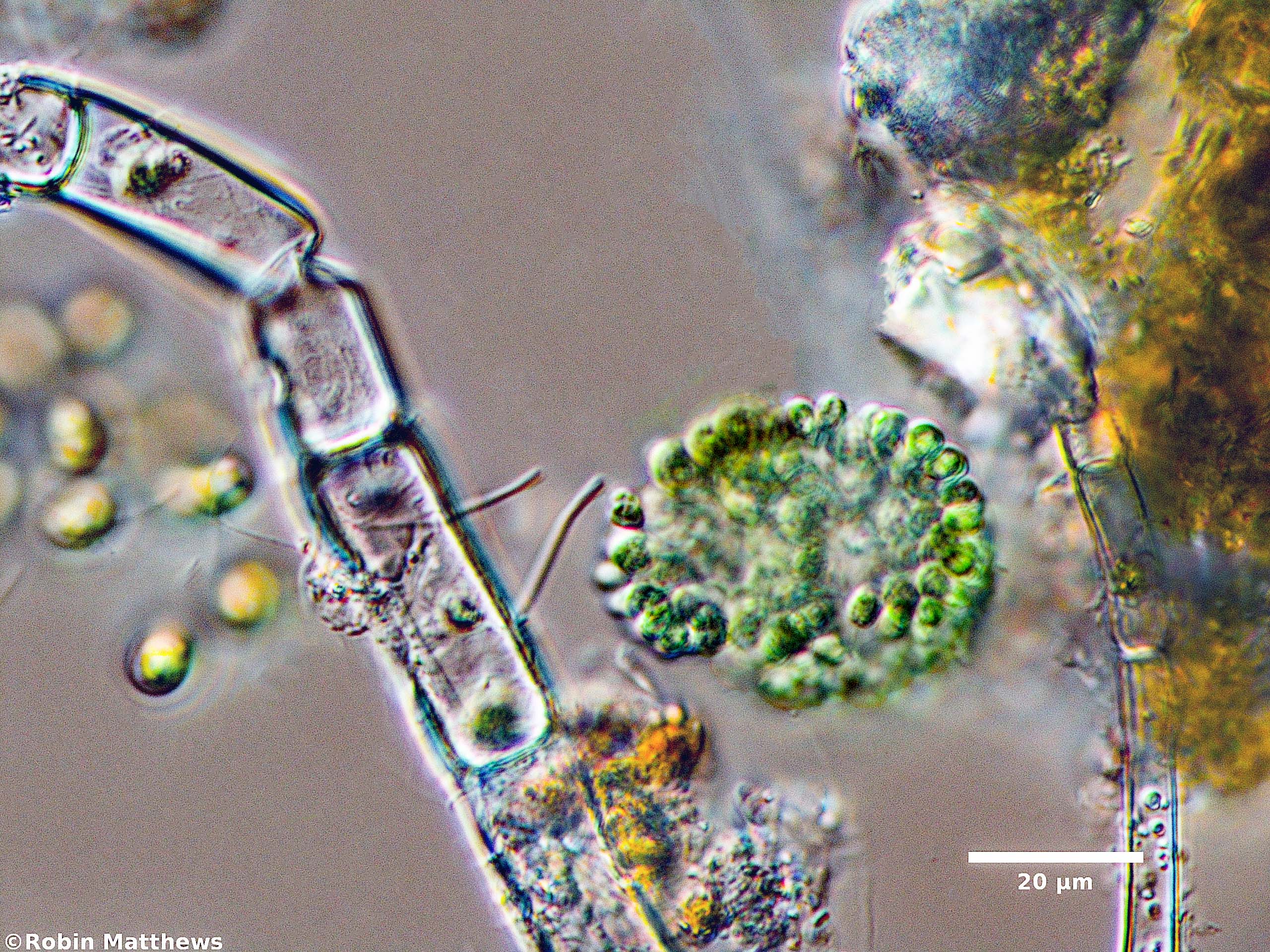 Cyanobacteria/Synechococcales/Coleosphaeriaceae/Coelomoron/sp/coelomoron-101.jpg