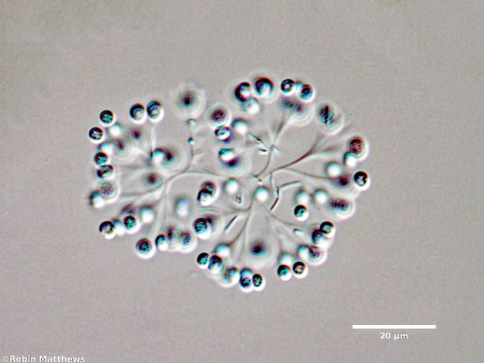 Cyanobacteria/Synechococcales/Coleosphaeriaceae/Snowella/litoralis/snowella-litoralis-103.jpg